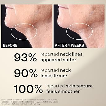 StriVectin Peptight™ Tighten & Lift Peptight 360 Degree Eye Serum, Neck Serum Roller and Face Serums with Tightening & Brightening Peptides for Wrinkles, Under Eye Bags and Puffiness