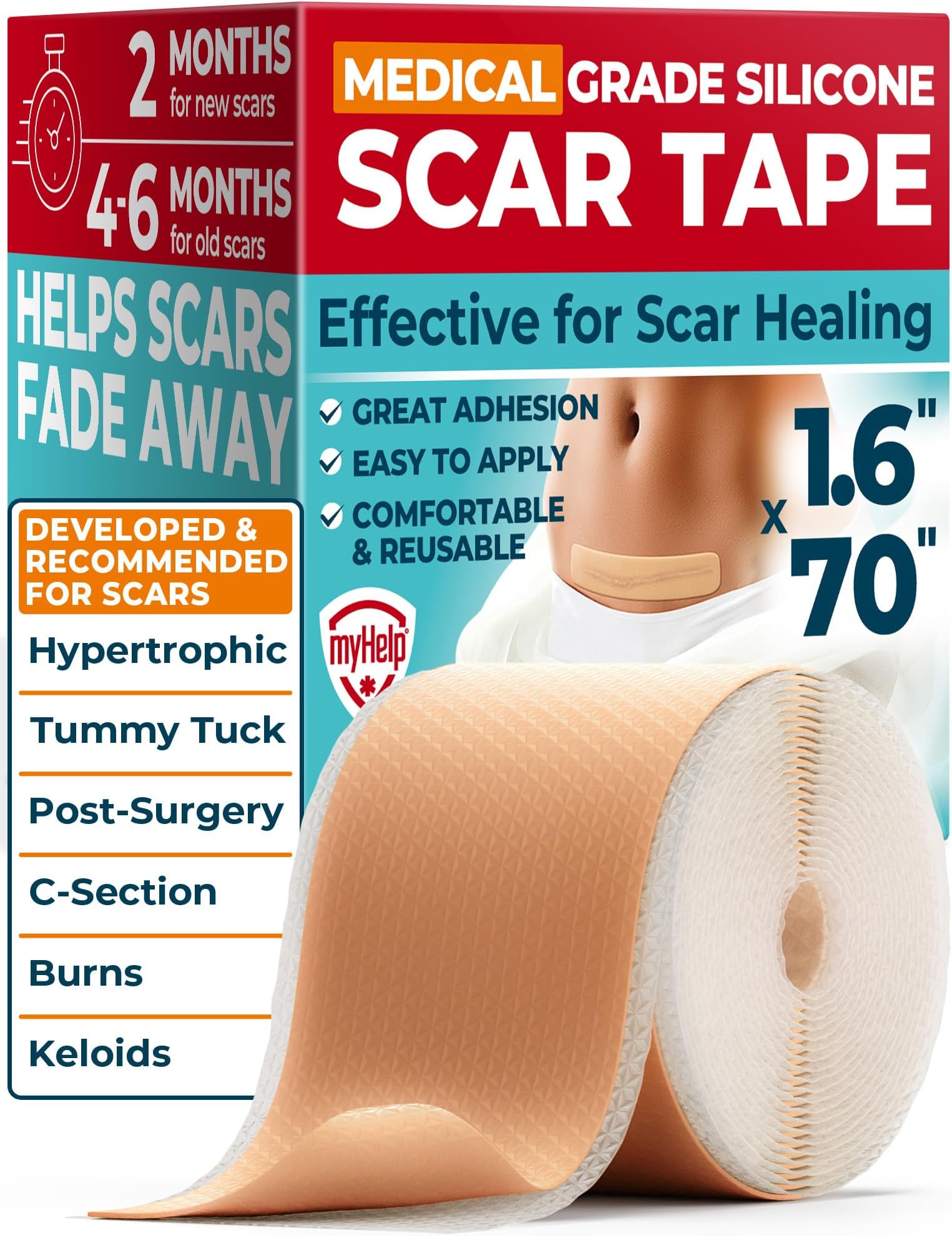 MYHELP Medical Grade Silicone Scar Tape - 1.6"x70" - Effective Scar Removal