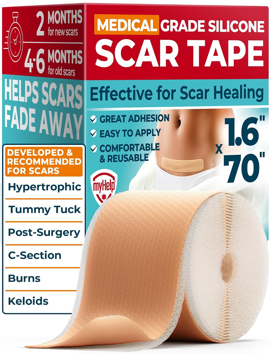 Medical Grade Silicone Scar Tape - 1.6”x70” - Effective Removal of Surgical, Keloid, C-Section, Tummy Tuck, Hypertrophic and Acne Scars - Easy to Use Treatment - Reusable Silicone Scar Sheets