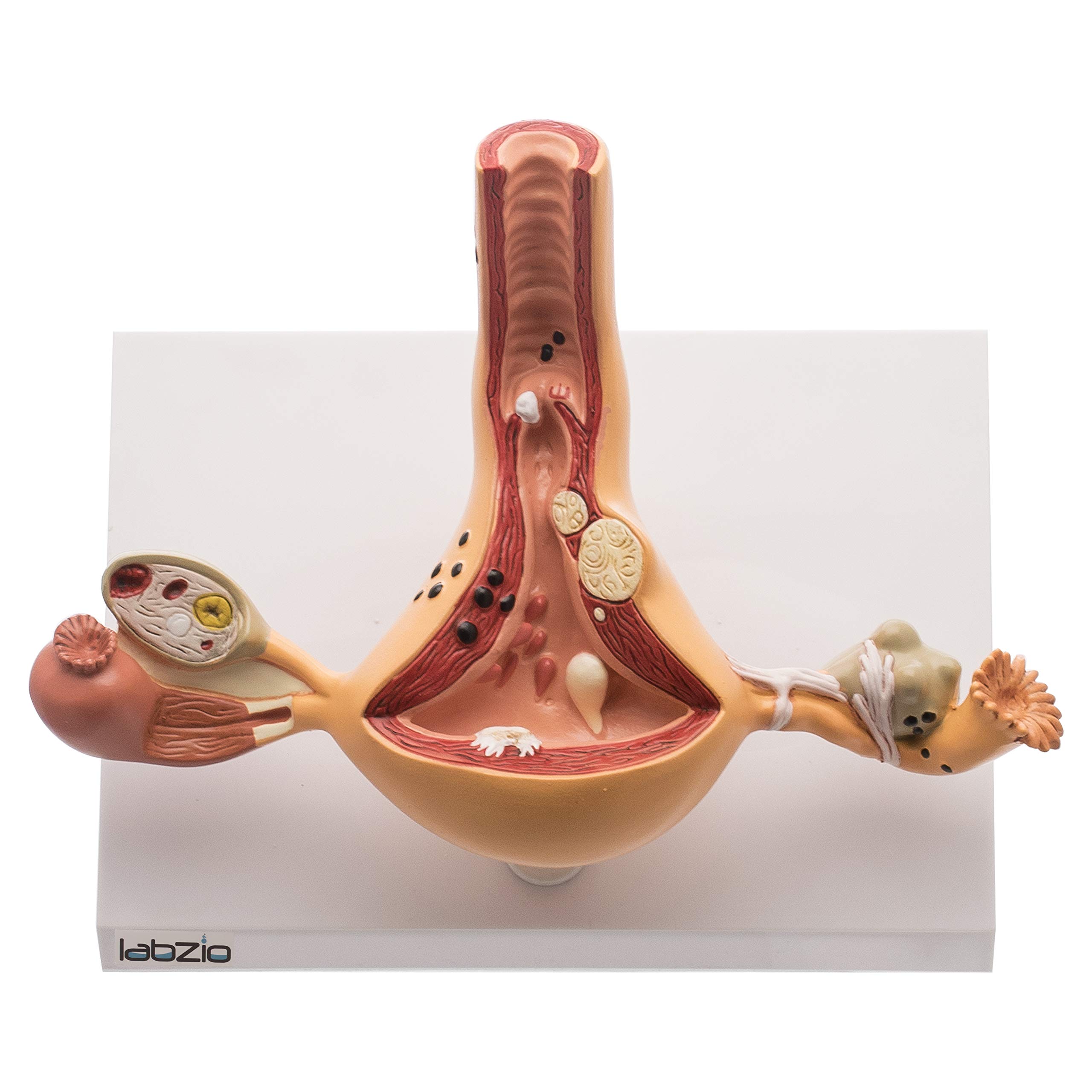 Labzio - Uterus and Ovary Anatomical Model with Pathologies | Female Reproductive Organ Replica with Base and Detailed Key Card | Medical Education Tool (B07Q4JDNHP) Amazon Price History, Amazon Price Tracker