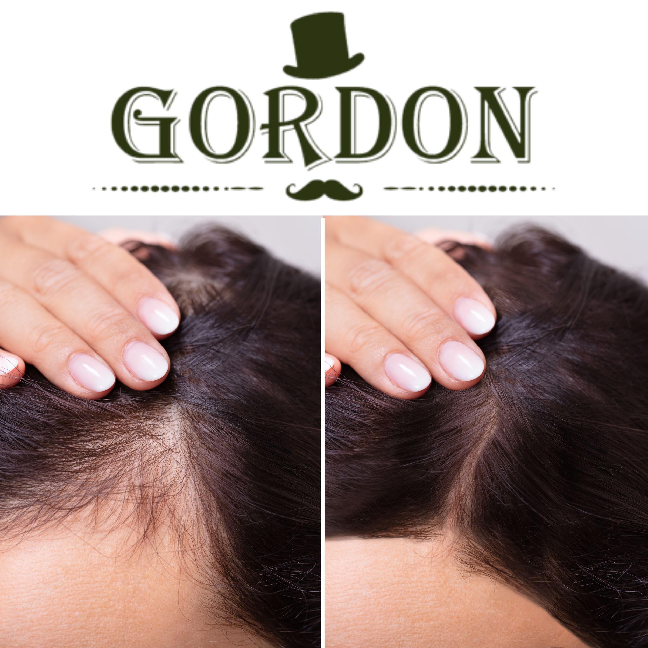 Fibre per capelli Gordon Set 2 Confezioni da 22 Grammi, copertura istantanea per il diradamento. (2 x Castano Scuro Senza Applicatore)
