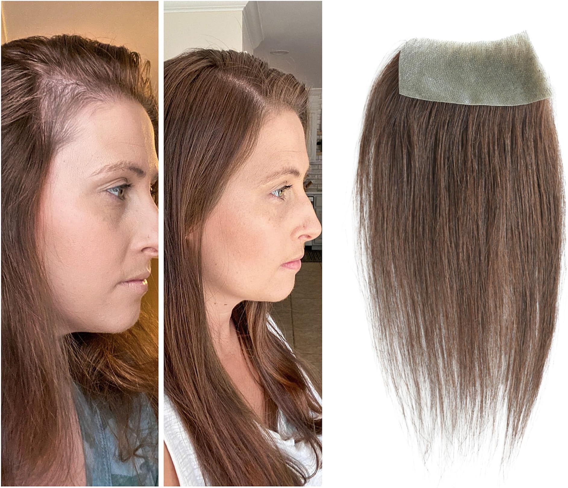 scar human hair replacement Accidental burns without hair for men women Hairline Loss Straight Tape in Replacement Toupee (Medium Brown, 1.57"x3")