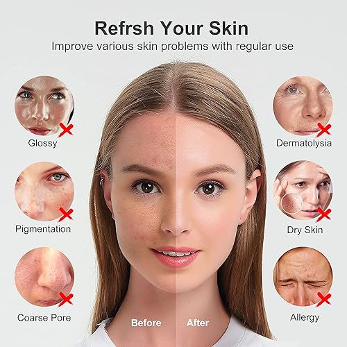 Vista 24 de Newbealer Vaporizador facial, mini vaporizador facial de aroma, humidificador facial de niebla caliente nano iónico para limpieza profunda facial