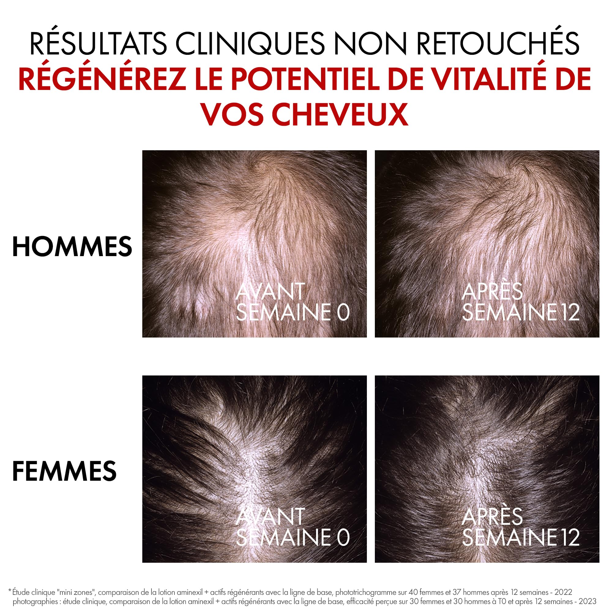 VICHY DERCOS Aminexil Clinical R.E.G.E.N. Booster Sérum Anti-Chute, Aminexil 1,5 % + Gingembre + Niacinamide, +14 000 Cheveux en 12 Semaines, Sans Paraben, 90 ml | Aminexil 1,5 %, Gingembre + Niacinamide, +14 000 Cheveux en 12 Semaines, Sans Paraben