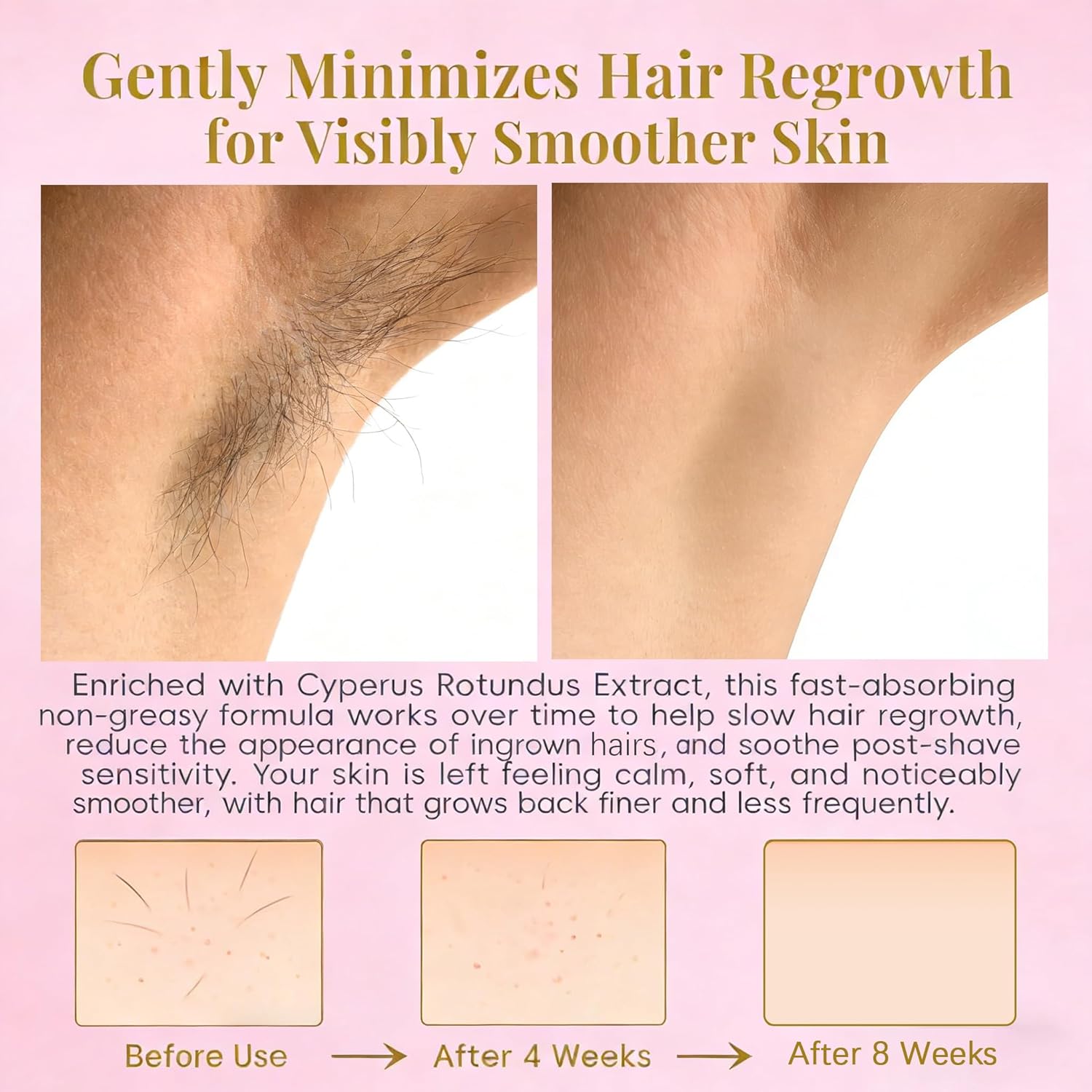 Cyperus Rotundus Oil Roll-On | Natural Nut Grass Oil, Helps Slow Hair Regrowth Appearance & Soothe Razor Bumps | Post-Shave & Post-Wax Soothing Care for Sensitive Skin on Face & Body, Non-Greasy