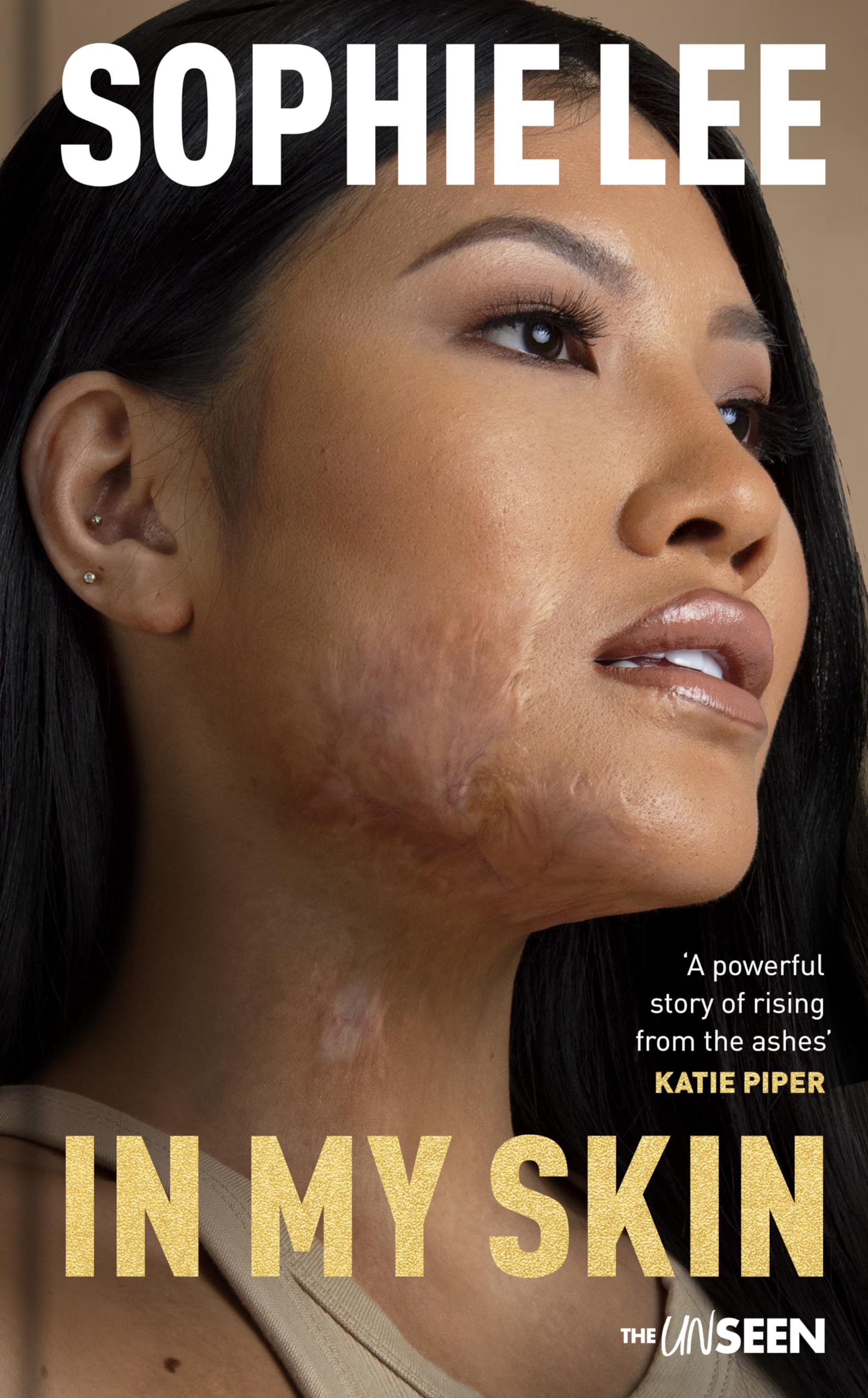 In My Skin: Learning to love your perfectly imperfect life (Katie Piper's The UnSeen)