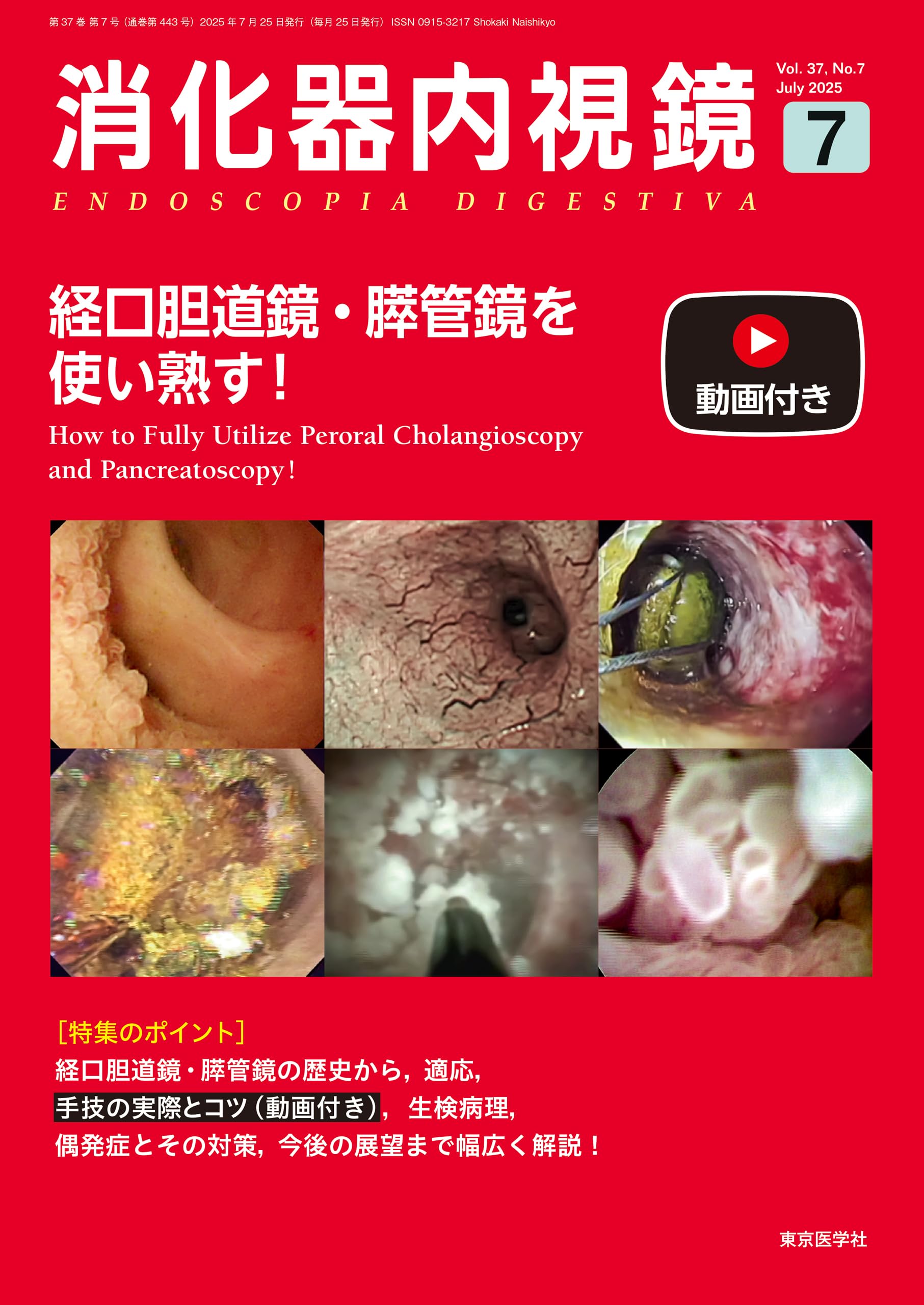 消化器内視鏡37巻7号2025年7月号 経口胆道鏡・膵管鏡を使い熟す