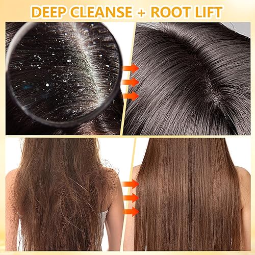 Miniatura 4 de Exfoliante de cuero cabelludo con extracto de arroz y ácido hialurónico, champú exfoliante 2 en 1 para tratamiento capilar, incluye masajeador de