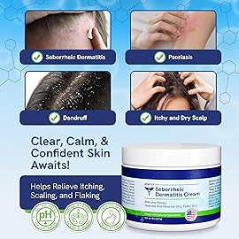 pHat 5.5 Seborrheic dermatitis Moisturizing Cream & Face Lotion for Women - Soothing Redness for Face & Body Cream - Hydrating for Dry Skin & Anti Itch Lotion (8oz)