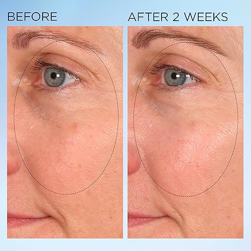 Miniatura 6 de Elizabeth Arden Cápsulas nocturnas de corrección de manchas claramente radiantes que iluminan visiblemente