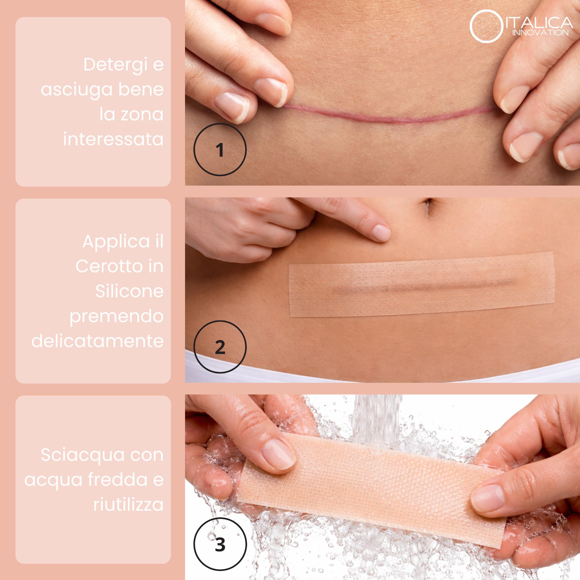 Cerotti in Silicone per Cicatrici, 4x300cm, Ipoallergenici e Riutilizzabili, Impermeabili Post Operatorio, per Cicatrici Chirurgiche, Cesareo, Acne e Cheloidi
