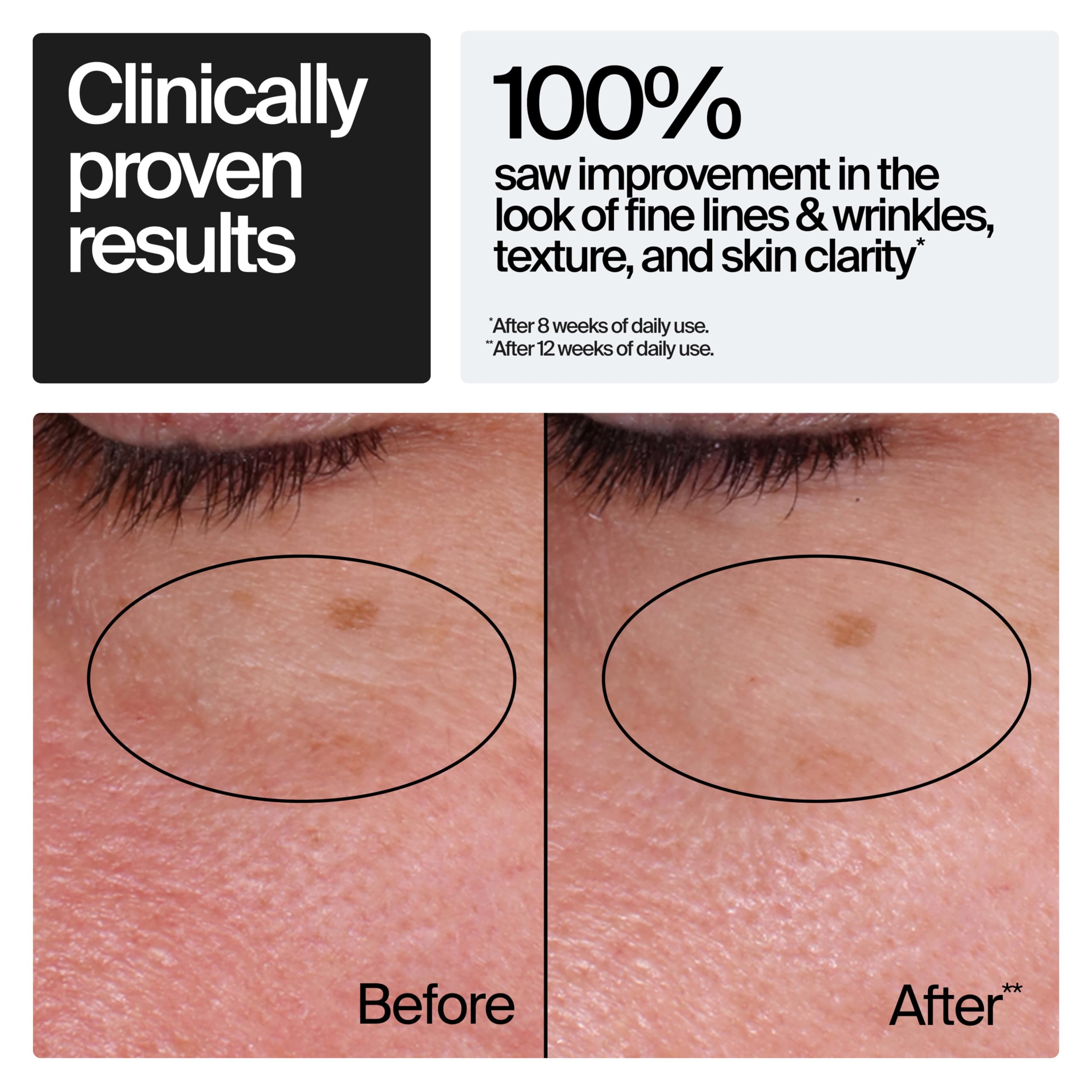 Amazon | Neutrogena モイスチャライジング 迅速なリンクルリペア