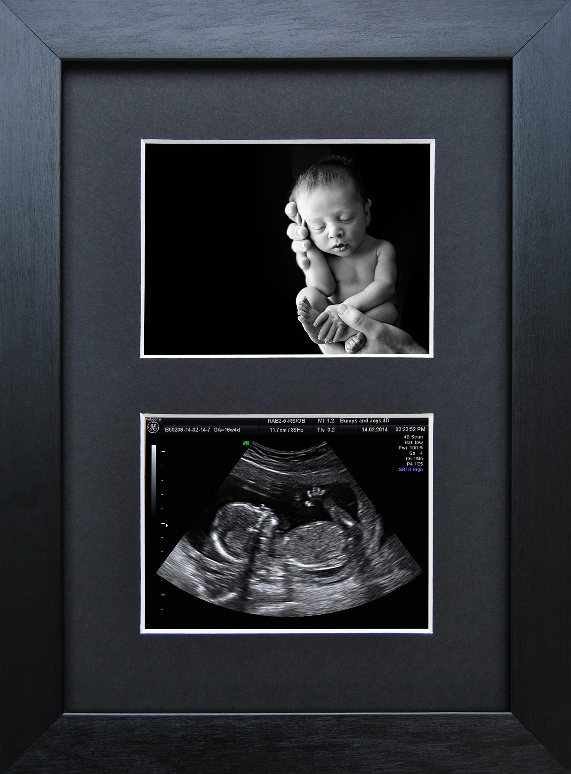 SignatureFrames.co.uk Pregnancy Ultrasound Sonogram Scan Photo Frame Double Aperture Black Frame Twin Mount, White