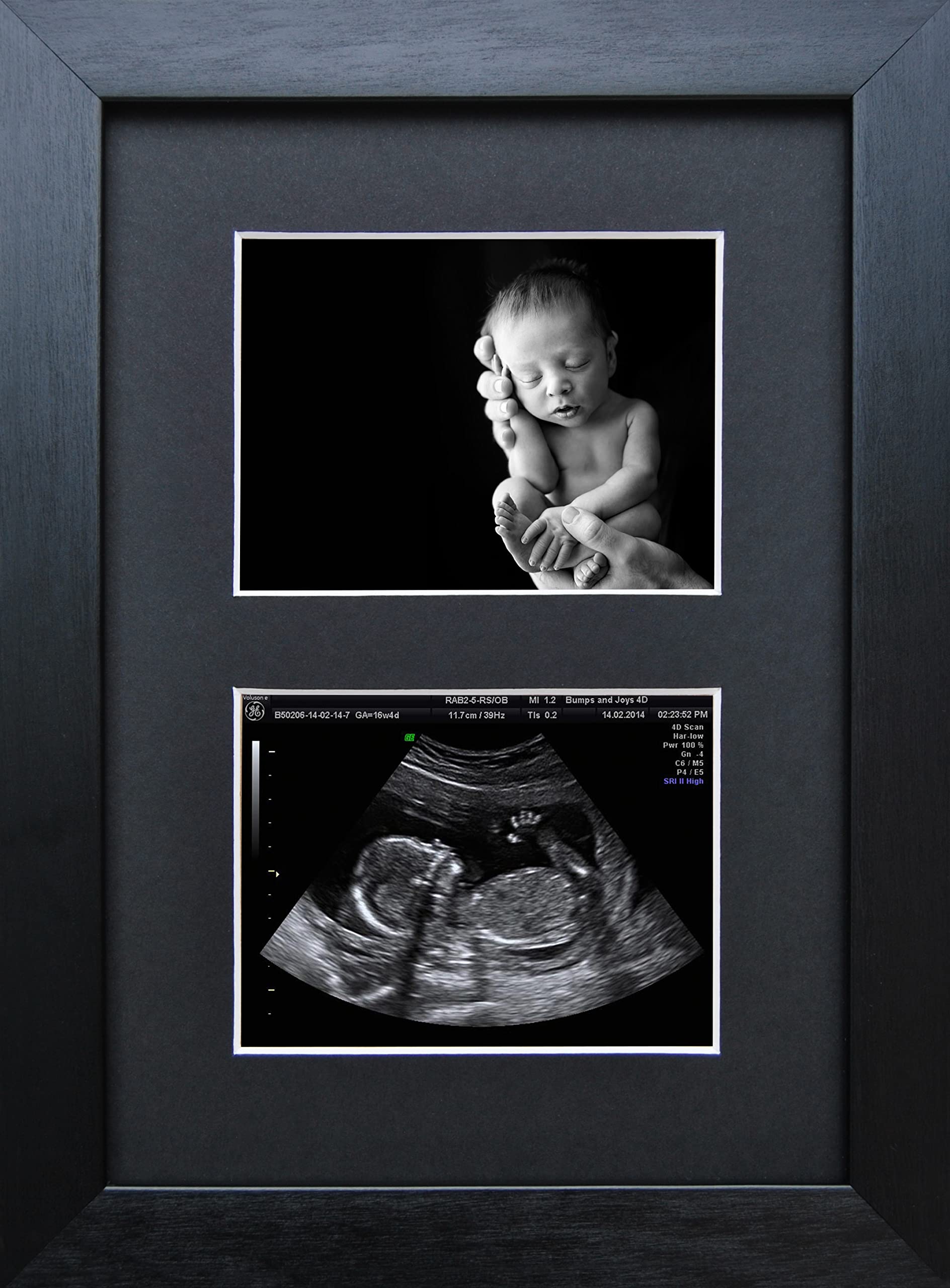 SignatureFrames.co.uk Pregnancy Ultrasound Sonogram Scan Photo Frame Double Aperture Black Frame Twin Mount, White
