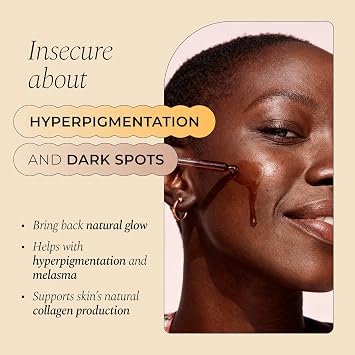 Glo Melanin Dark Spot Remover Serum for Face with Vitamin C Reduces Discoloration and Hyperpigmentation