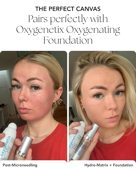 Oxygenetix Oxygenating Hydro-Matrix (2.54oz) | Lightweight Aloe-Based Face Moisturizer with Hyaluronic Acid for Sensitive, Dry, or Compromised Skin