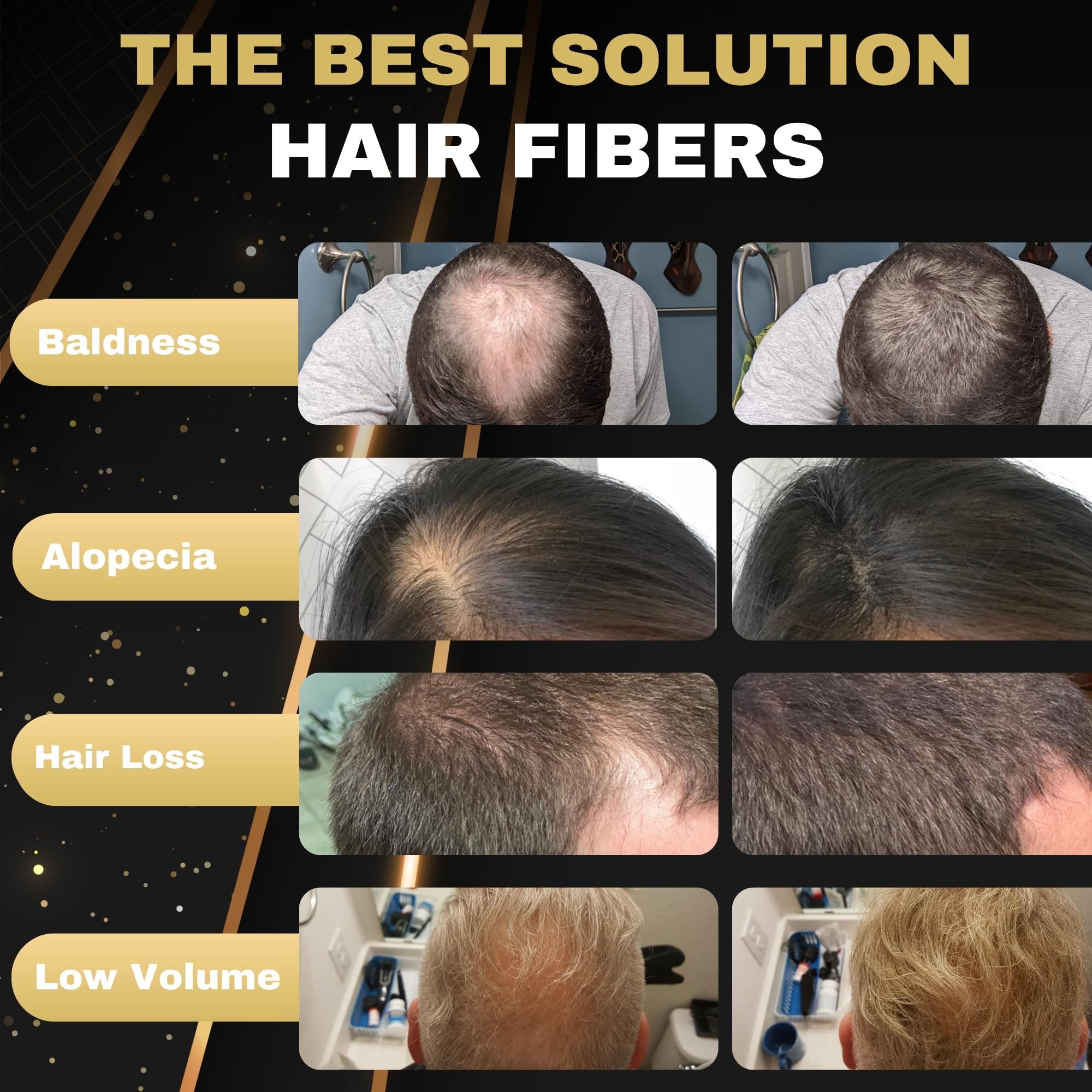 Hair Fibres Salvathor Duran 25 g - Kit 3 Units (Fibers + Applicator + Hairline Comb) - Hair Fibre (Medium Brown) - Image 2