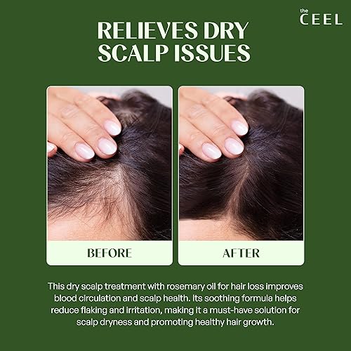 Miniatura 8 de The Ceel Aceite de romero para el crecimiento del cabello con gotero, fórmula vegana nutritiva y fortalecedora para cabello dañado, picazón en el