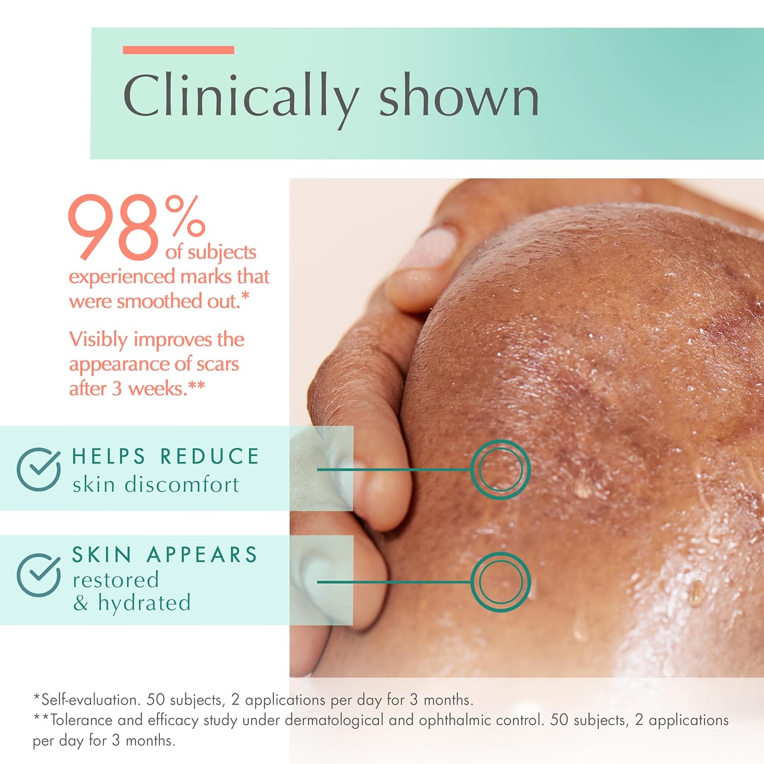 Avène Cicalfate+ Scar Gel, Silicone Massage Gel for Superficial & Dermatological Scars, 1 Fl Oz - Image 2