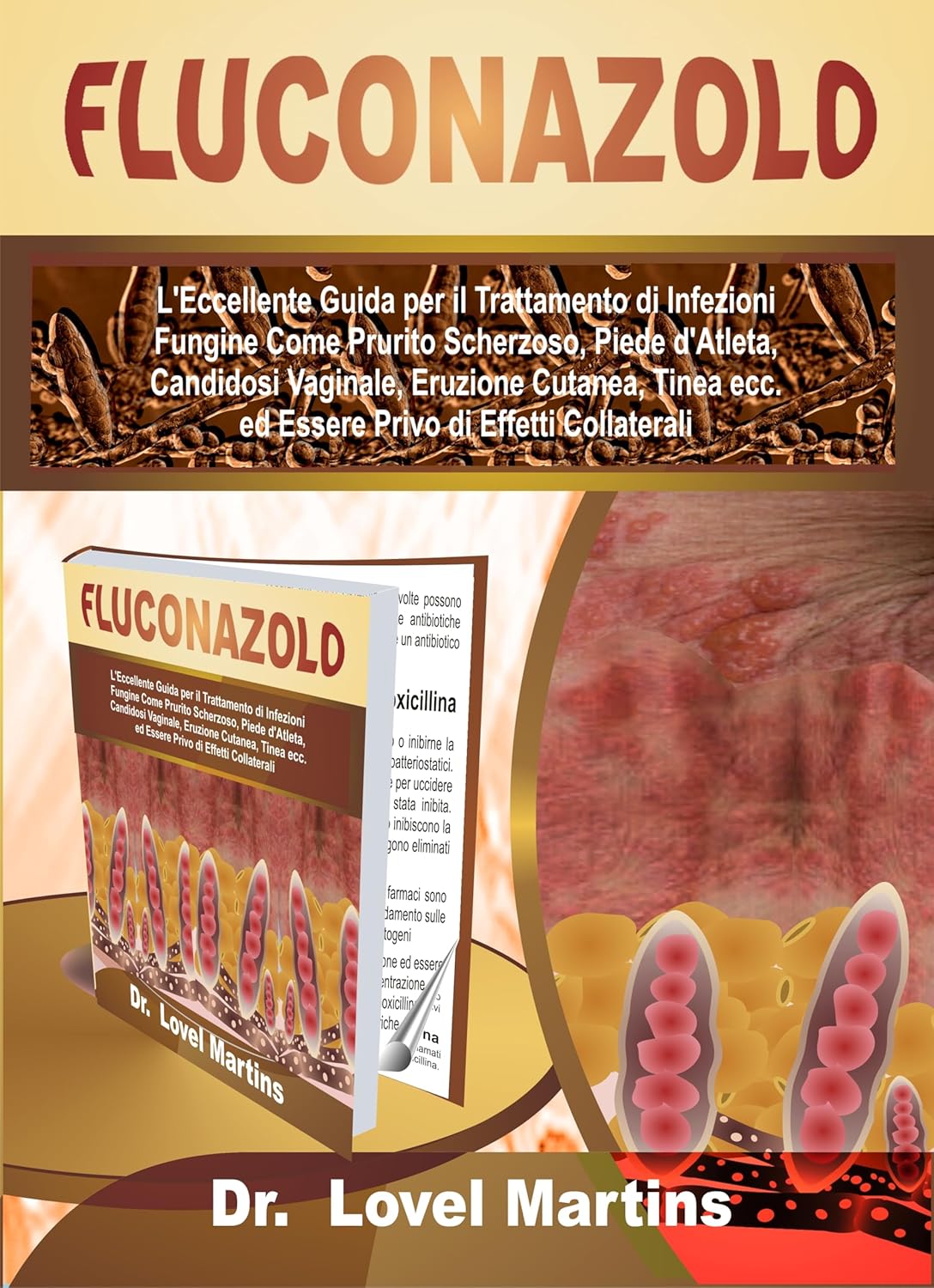 FLUCONAZOLO: L'Eccellente Guida per il Trattamento di Infezioni Fungine Come Prurito Scherzoso, Piede d'Atleta, Candidosi Vaginale, Eruzione Cutanea, Tinea ... di Effetti Collaterali (Italian Edition)      Kindle Edition