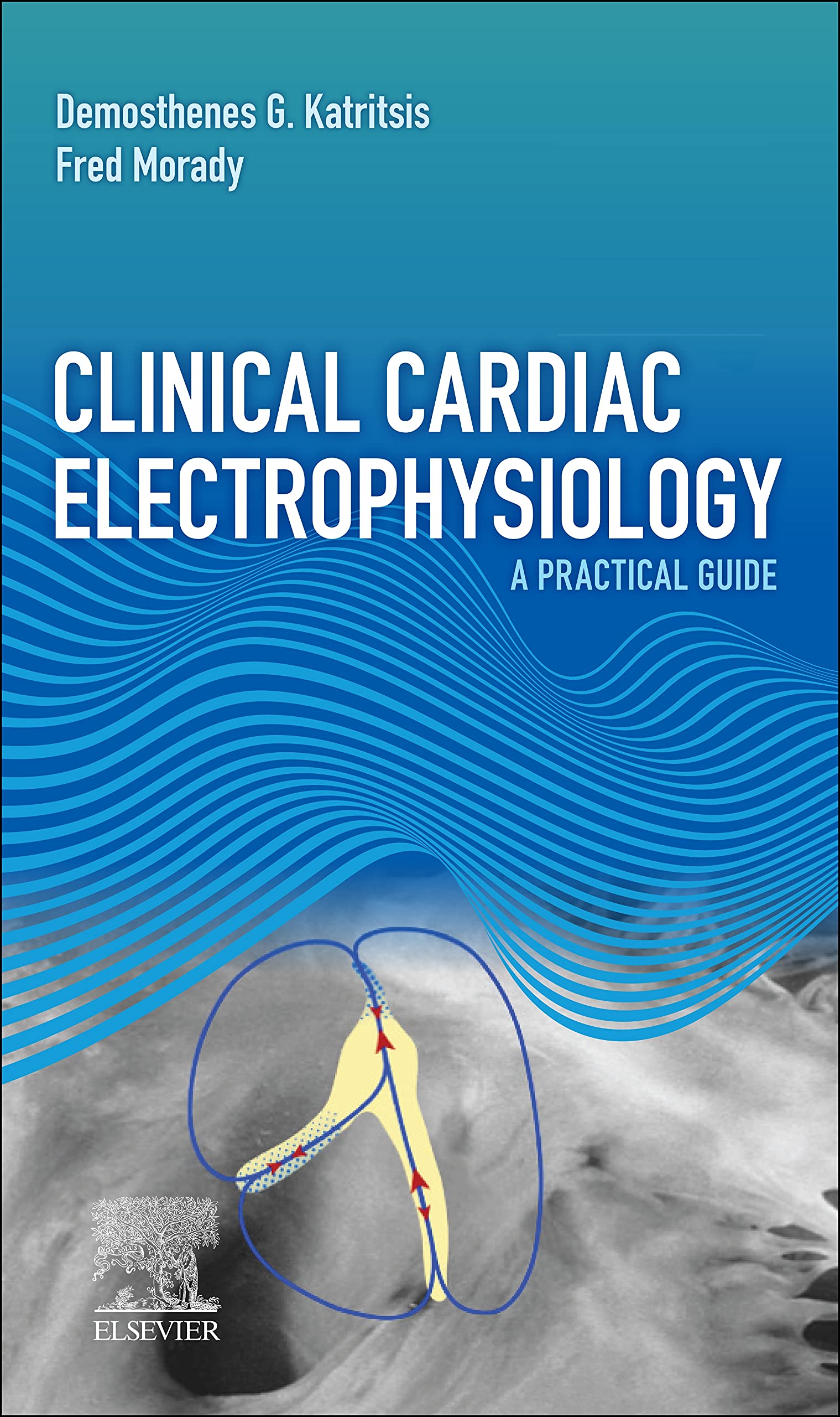 Clinical Cardiac Electrophysiology - E-Book: A Practical Guide