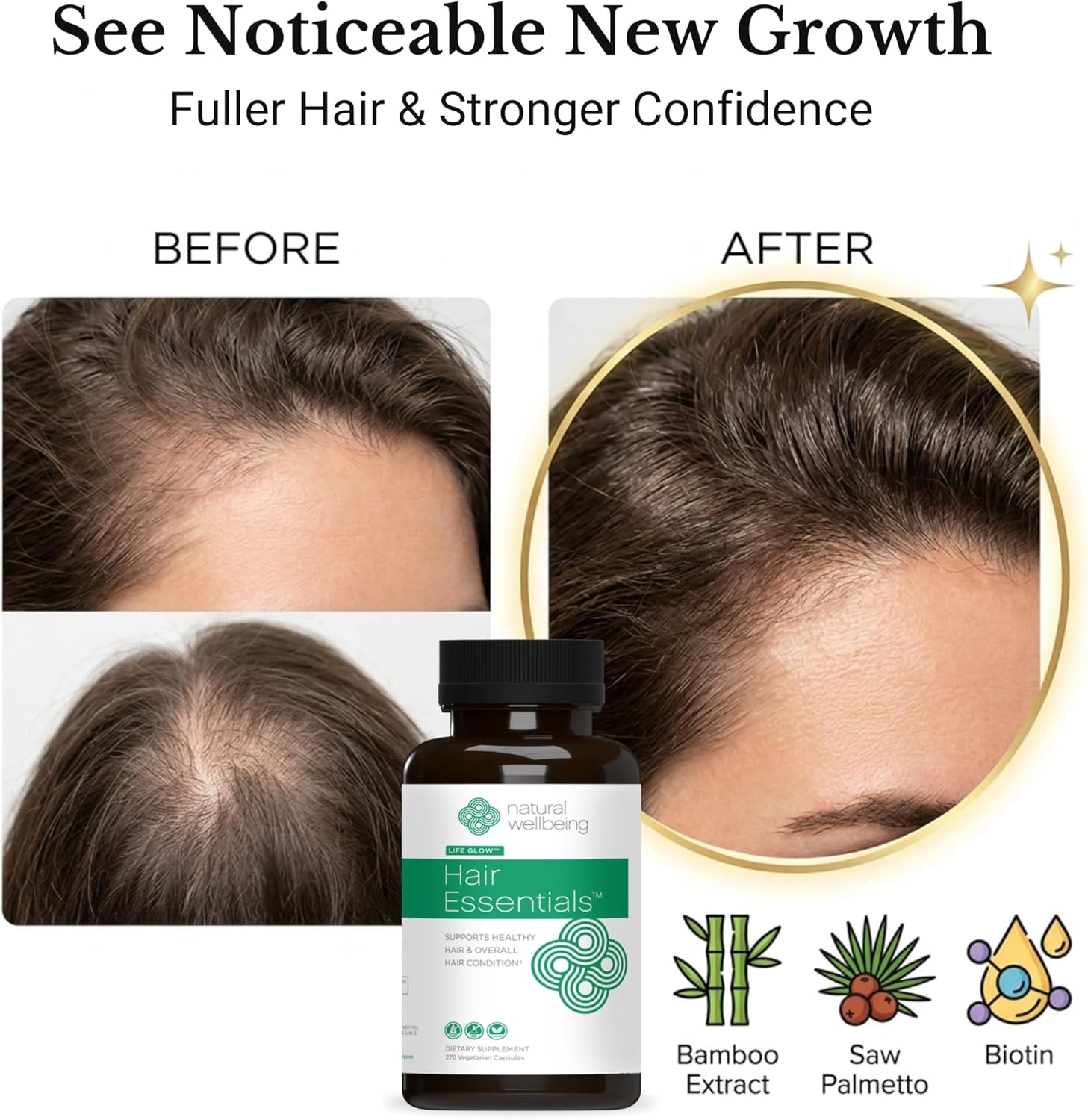 Natural Wellbeing Hair Essentials – DHT Blocker Hair Growth Supplement for Women & Men – Saw Palmetto, Biotin, – Vegan Capsules – Stops Shedding & Thinning (270 Count, 3-Month Supply)