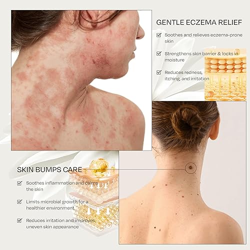 Miniatura 3 de Crema de veneno de abeja y 2 unidades, crema de tratamiento de piel de veneno de abeja, para todo tipo de piel, suave y lisa, veneno de abeja,