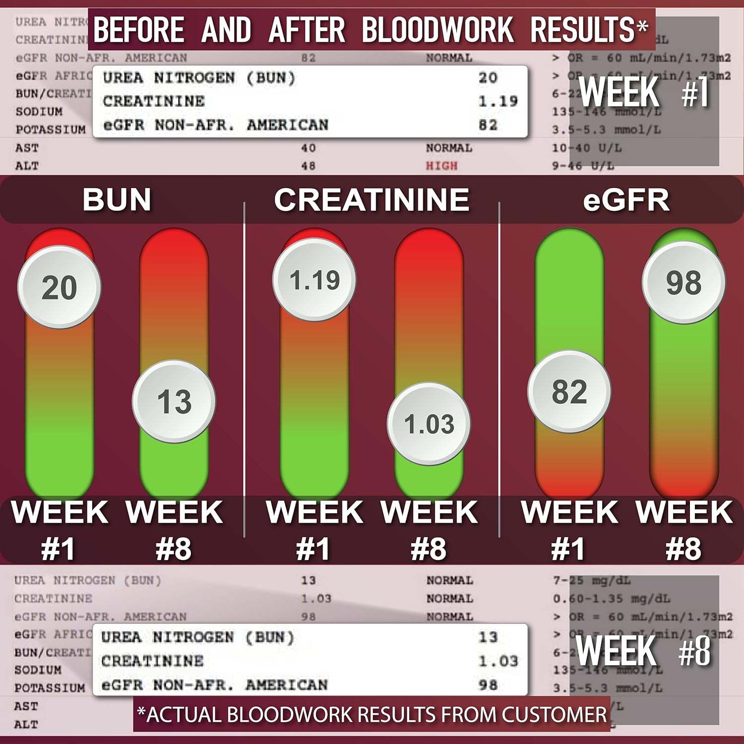 Leviathan Super Kidney Cleanse & Urinary Detox Formula | Optimal Kidney Health & Gallbladder Formula | Full Restore & Detox - Manage Kidney Stones | 120 Caps - Image 4