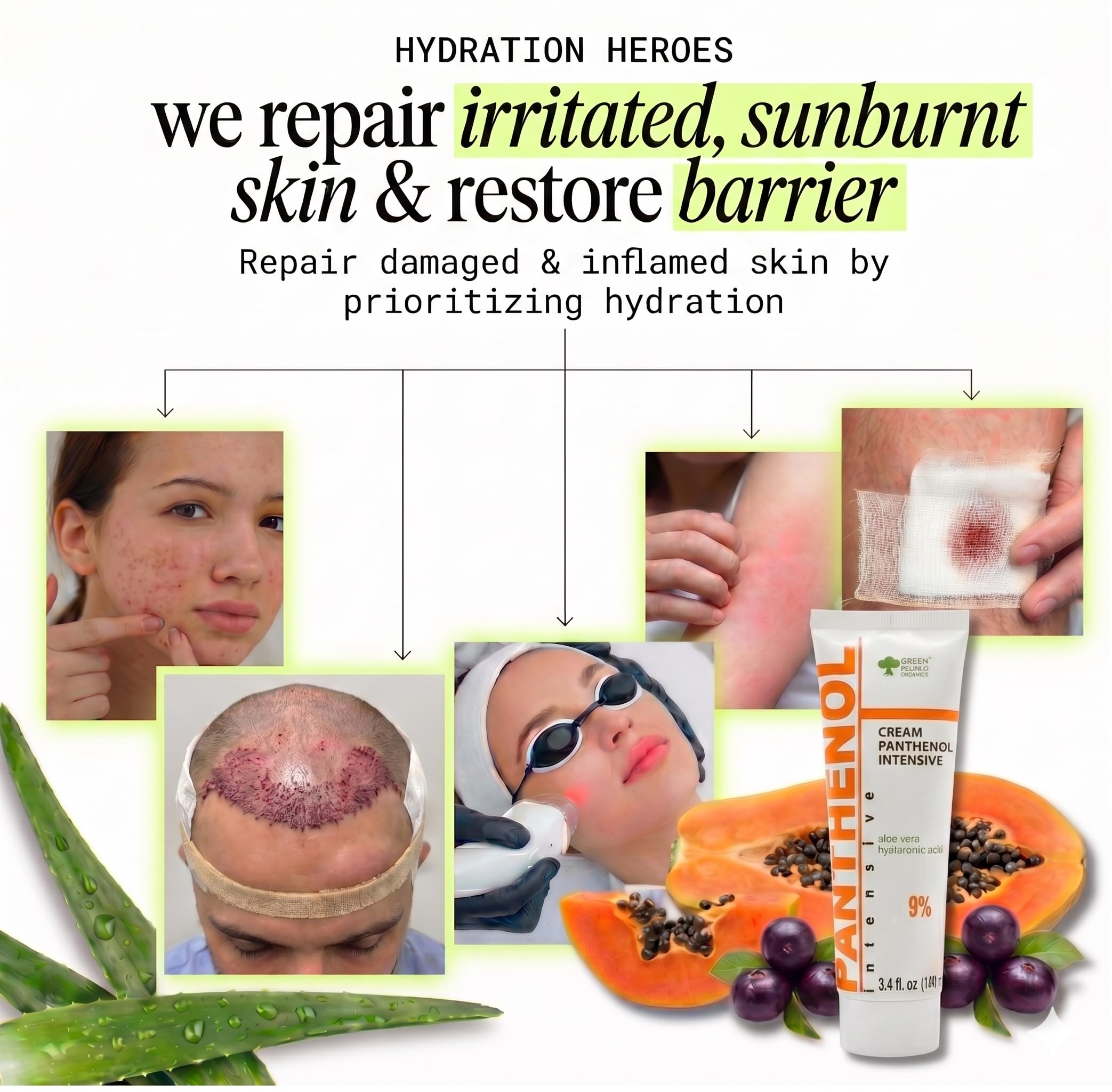 9% Intensive Panthenol-Creme mit Aloe Vera & Hyaluronsure