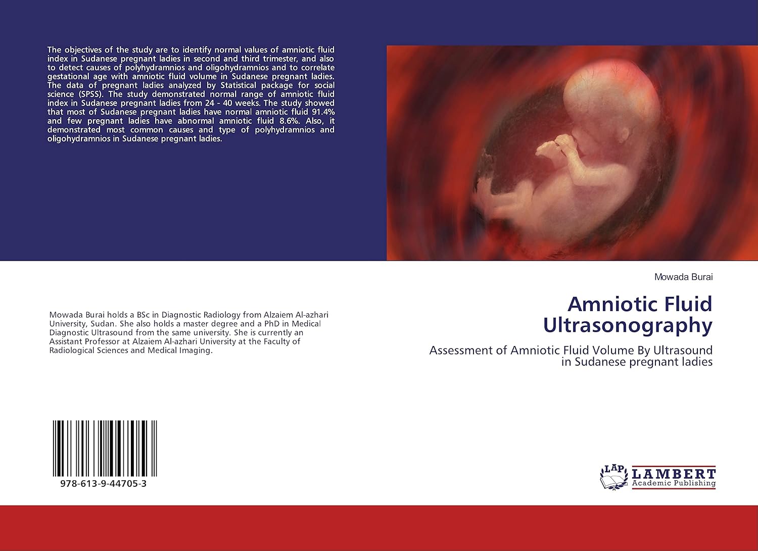 Amniotic Fluid Ultrasonography: Assessment of Amniotic Fluid Volume By ...