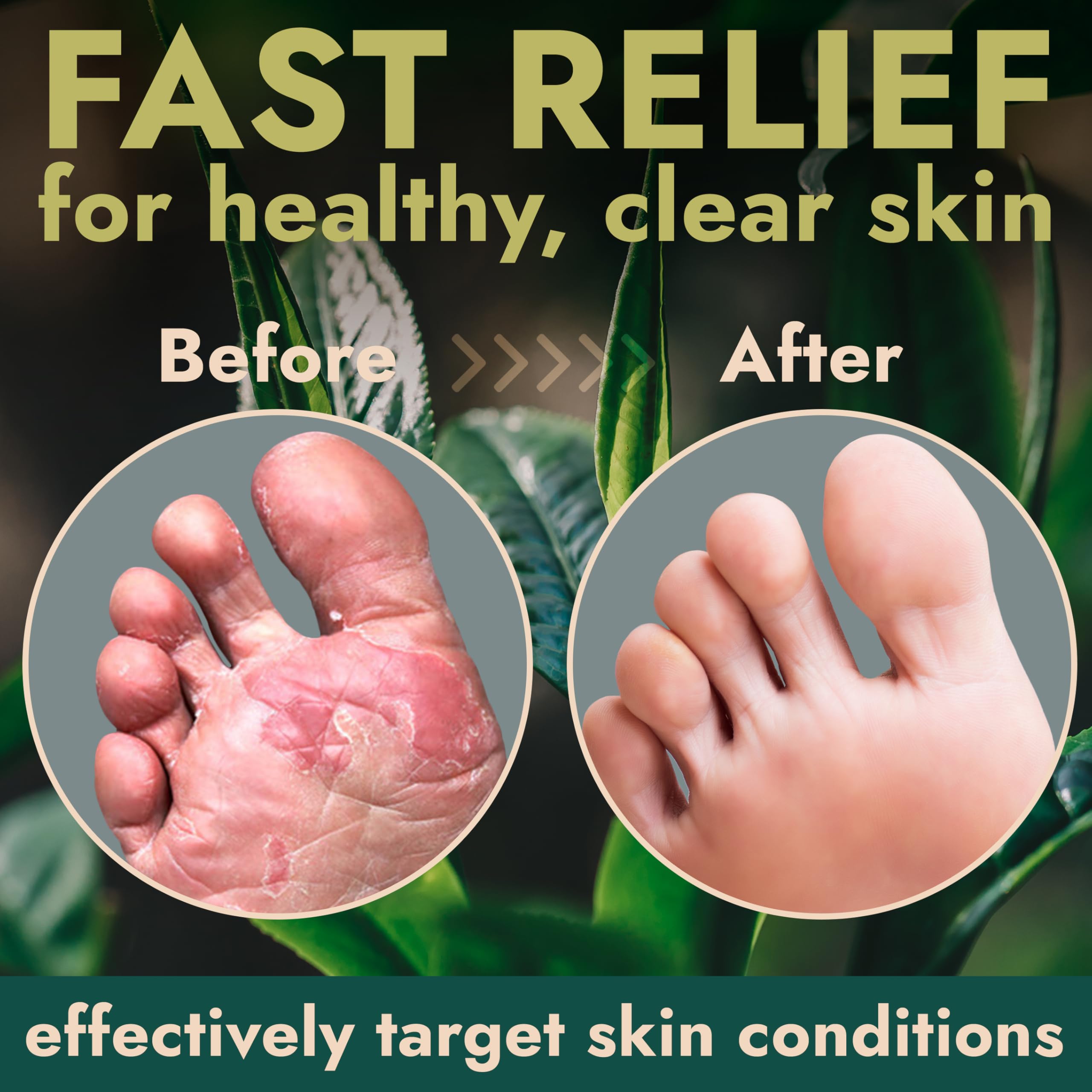 Terramed Just Think Comfort Foot Spray with Tea Tree Oil | Antifungal Treatment for Jock Itch, Nail Fungus & Ringworm | Fast Absorbing & Deep Penetrating Relief | Soothes Itching & Burning | 120ml — Amazon image 5