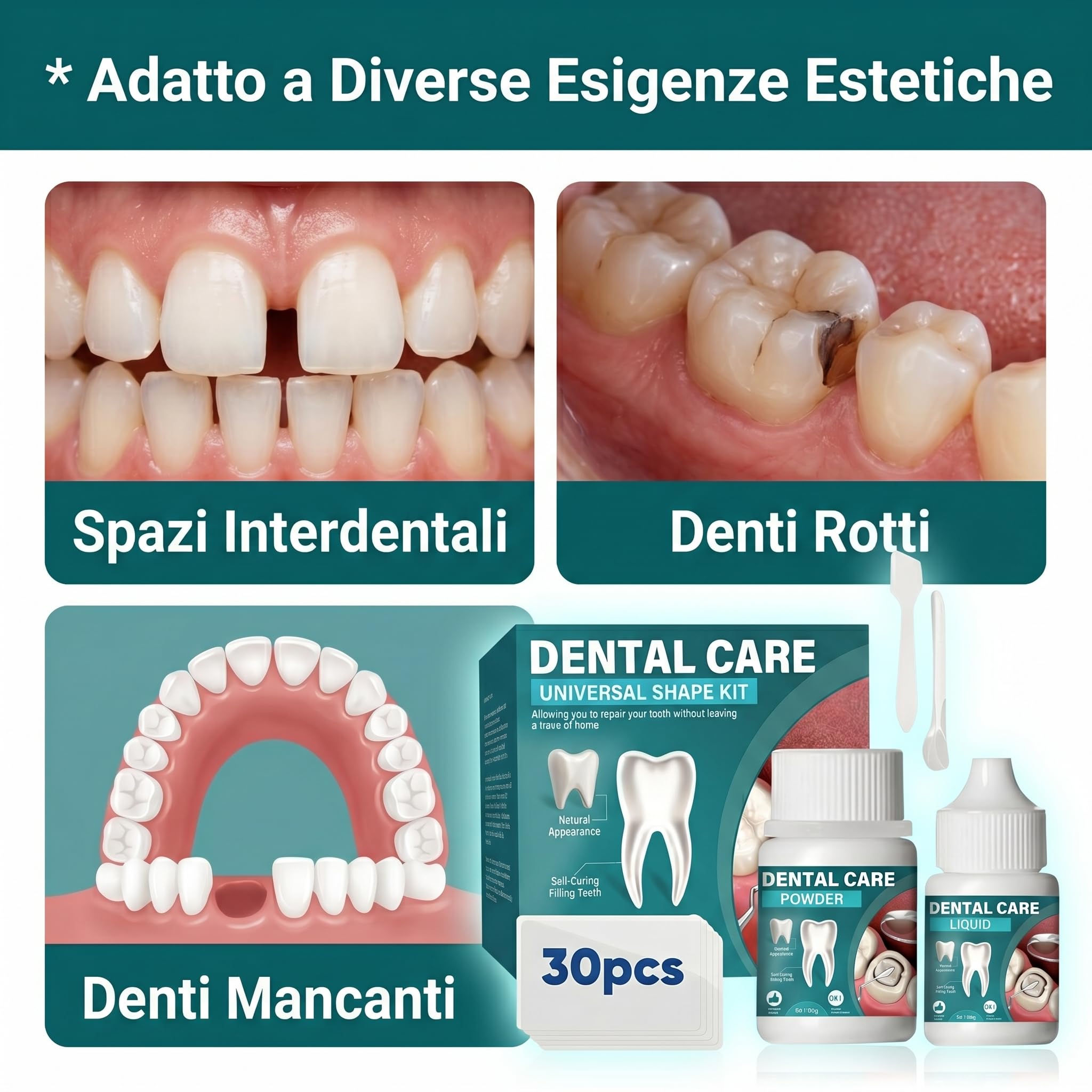 Temporaneo per Riparazione Estetica dei Denti - Materiale Modellabile Fai-da-Te per Uso Domestico - Soluzione Cosmetica Provvisoria per Piccole Imperfezioni Dentali