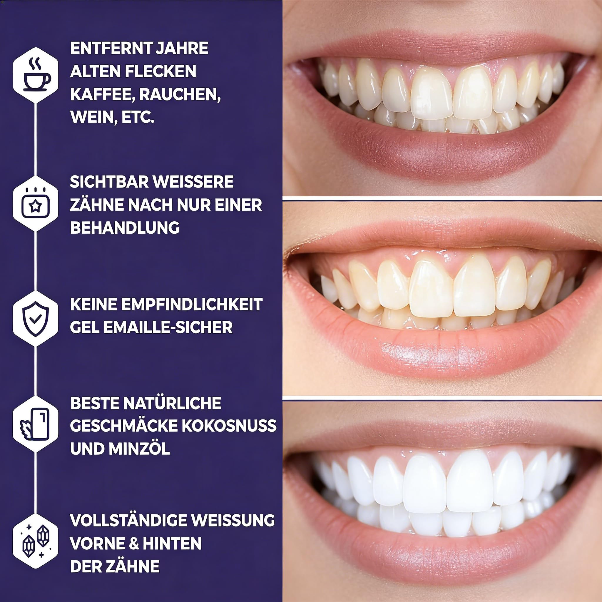 GlowDent VIOLET+ Zahnaufhellungsstreifen sanfte Zahnaufhellung, sicher für Zahnschmelz, Whitening Streifen ohne Reizung zur Zahnpflege