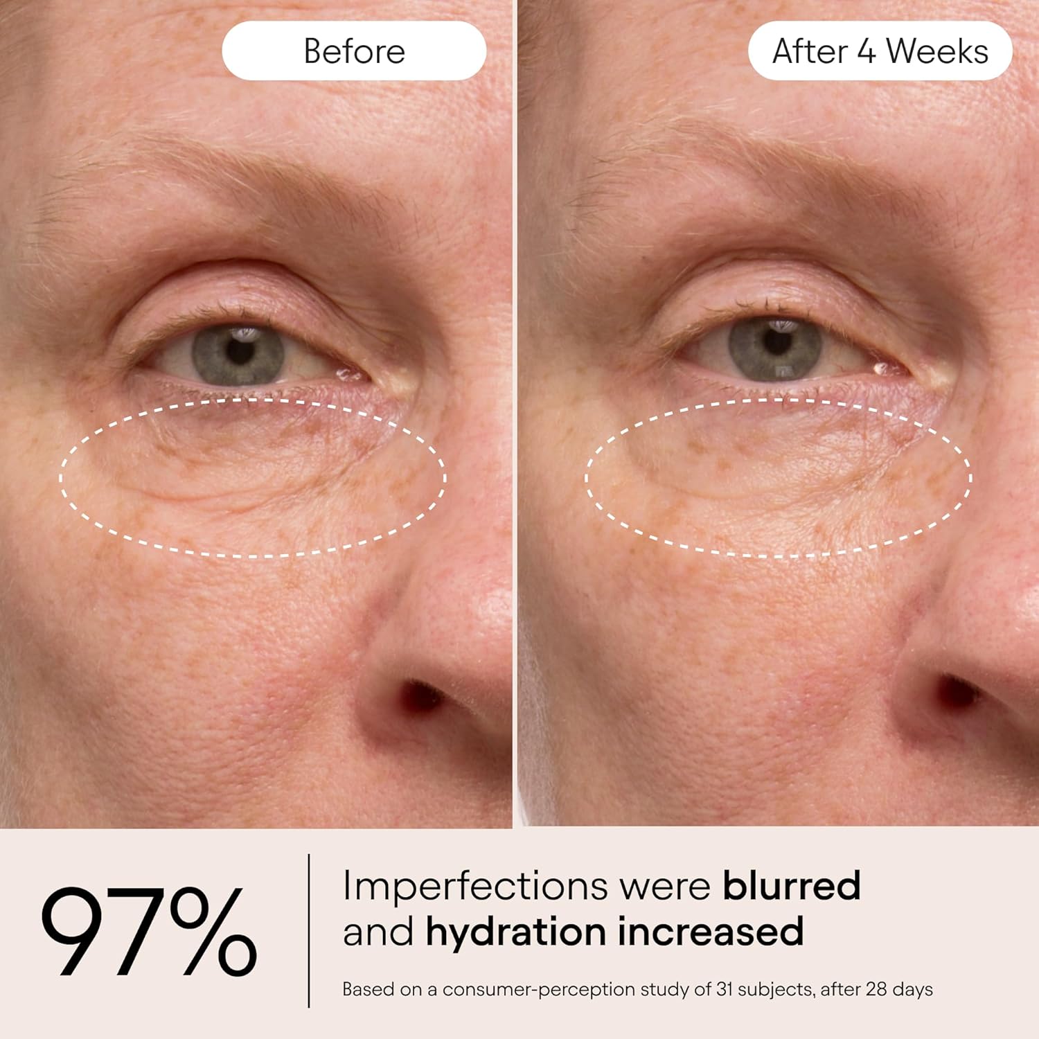 ALPYN Instant Bright Eye with Peptides & Niacinamide | Brightens Dark Circles, Visibly Firms & Softens Fine Lines | 0.5 Fl Oz / 15 ml