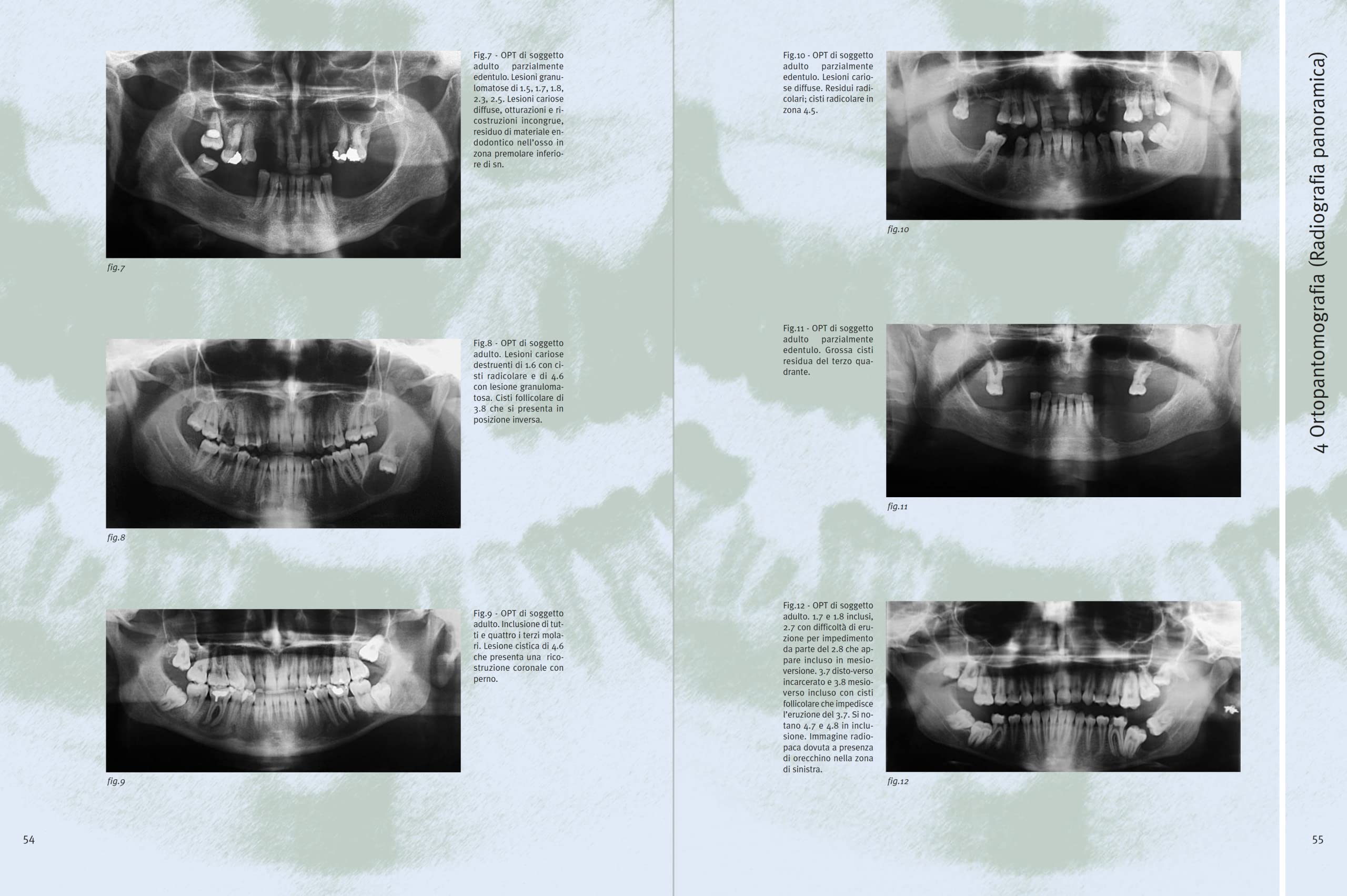 Atlante di radiologia odontoiatrica. A fini diagnostici