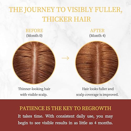 Miniatura 4 de Minoxidil para el crecimiento del cabello con biotina, solución tópica de suero de minoxidil extra fuerte con romero para tratamientos de