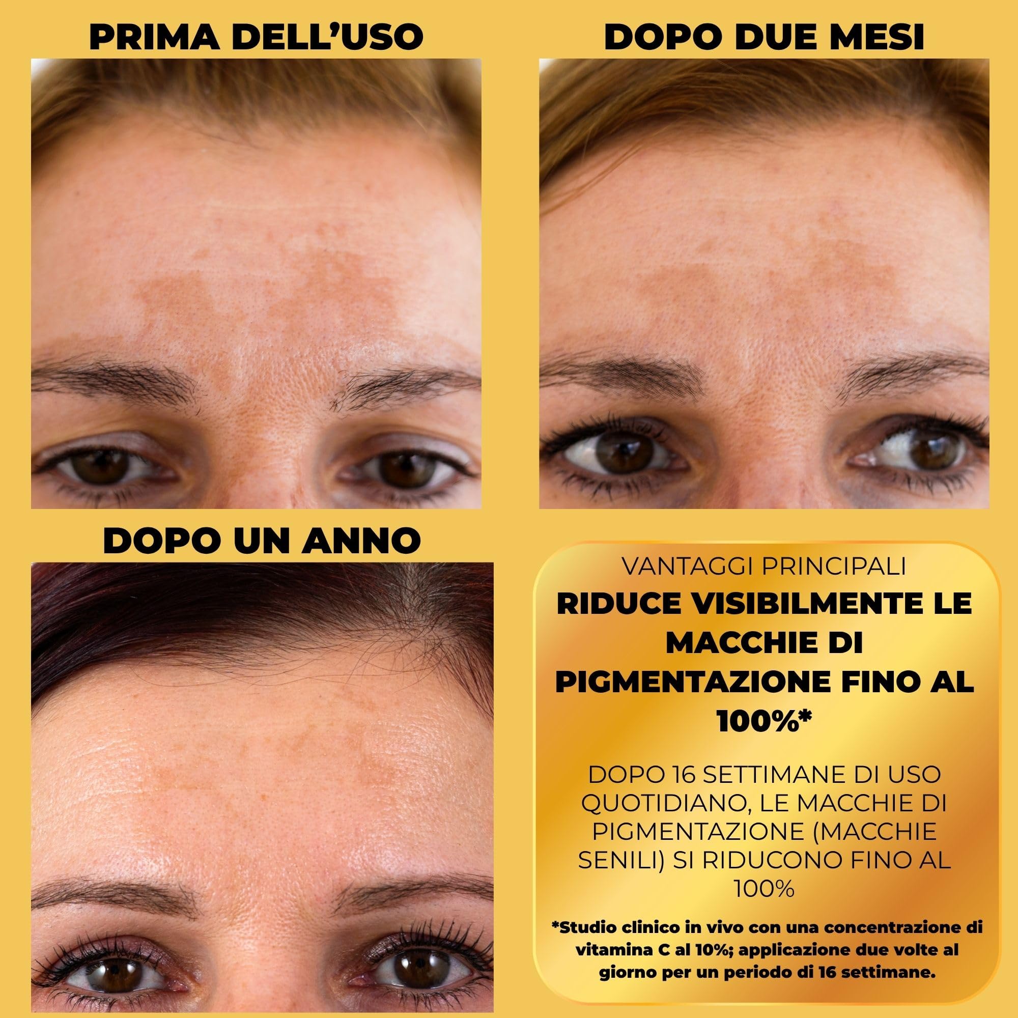 Afrodita Professional C10 Vitamina Super Shot Siero | 10% vitamina C stabilizzato contro le macchie di pigmentazione | Siero sbiancante anti-invecchiamento con effetto bagliore per tutti i tipi di