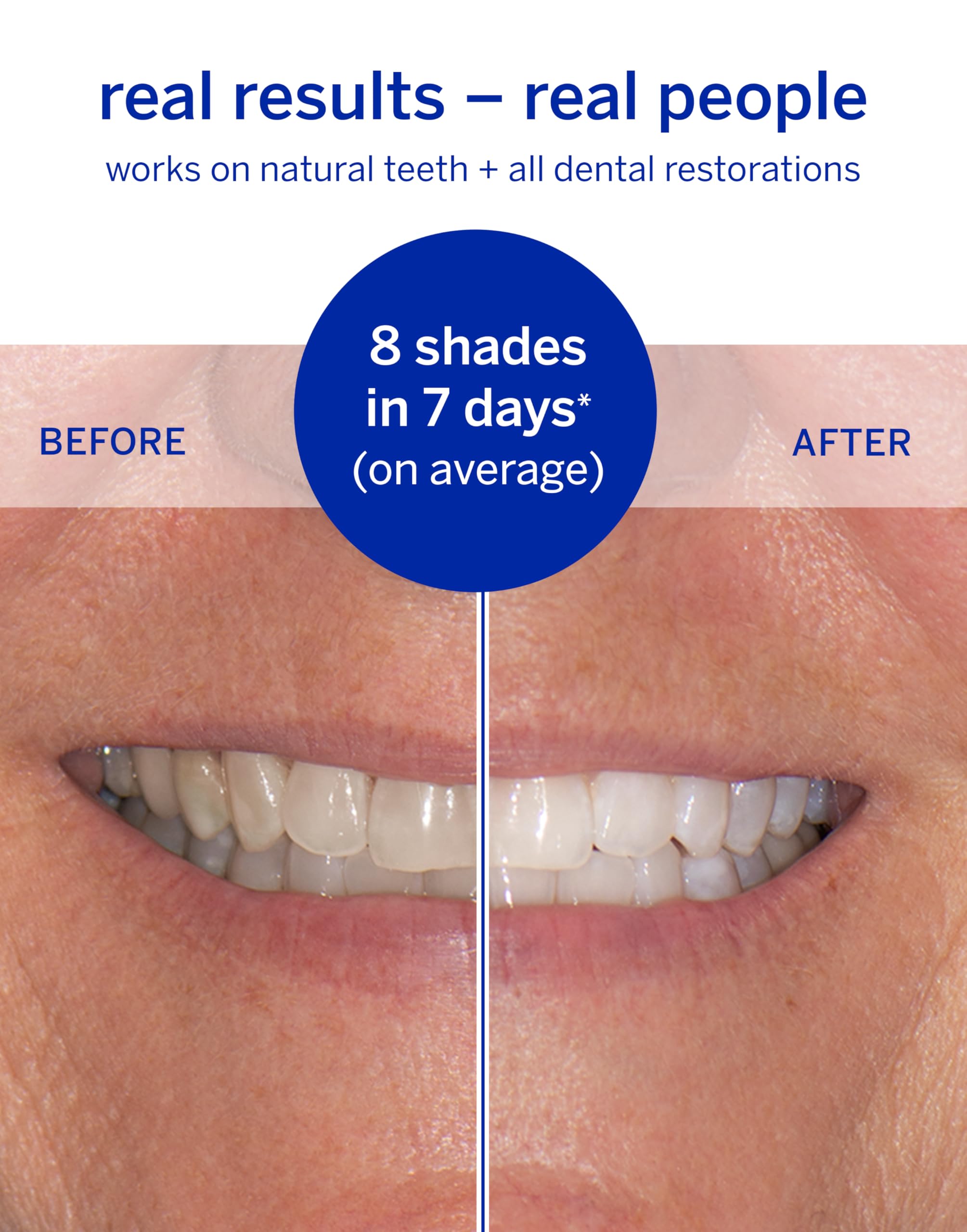 Supersmile Whitening System – Toothpaste (1.4 oz) & Accelerator (1.2oz) & 14 Dissolving Whitening Strips – TSA Kits