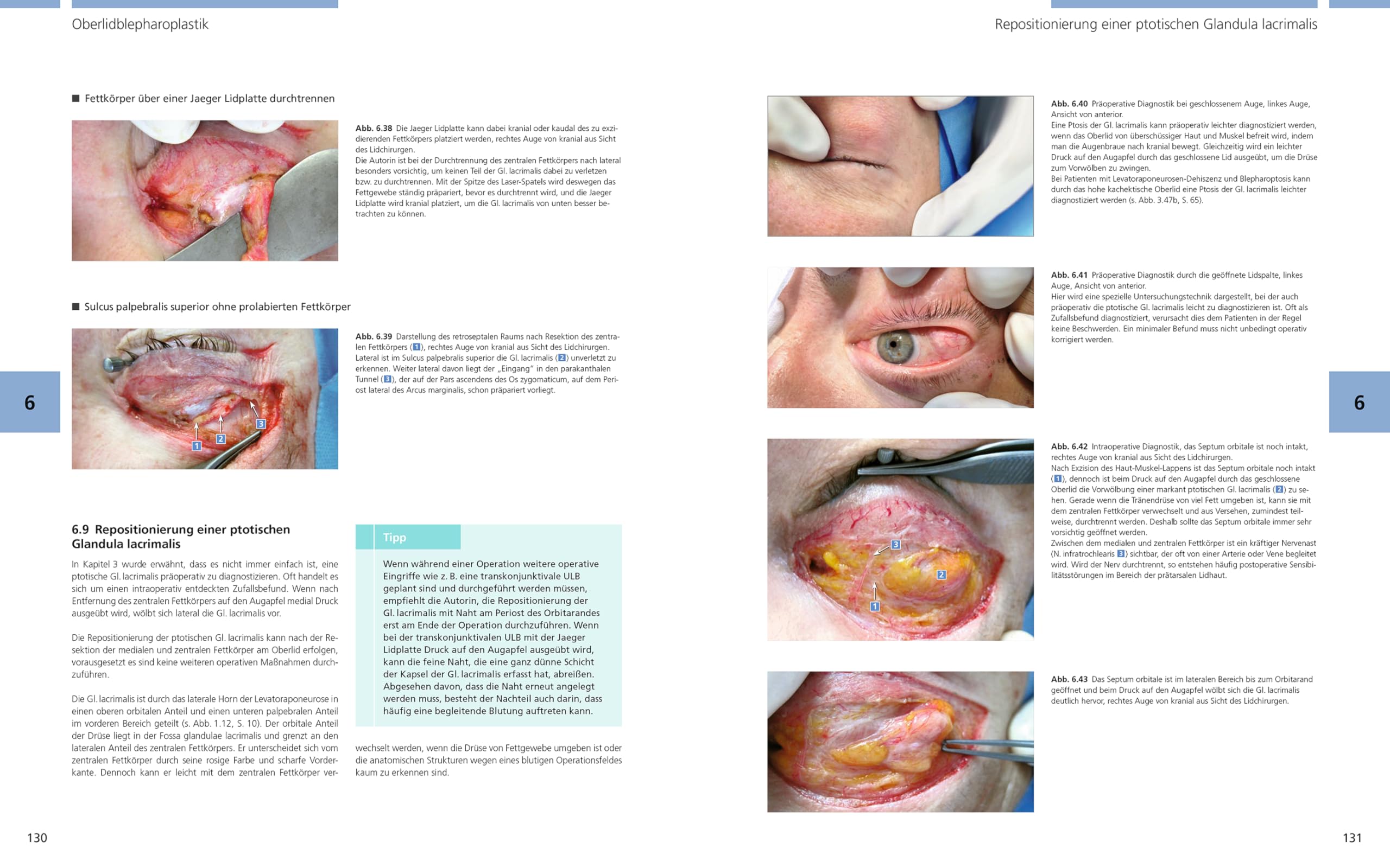 Bildatlas Lidchirurgie: Angewandte Anatomie | Untersuchung | Plastische Lidchirurgie