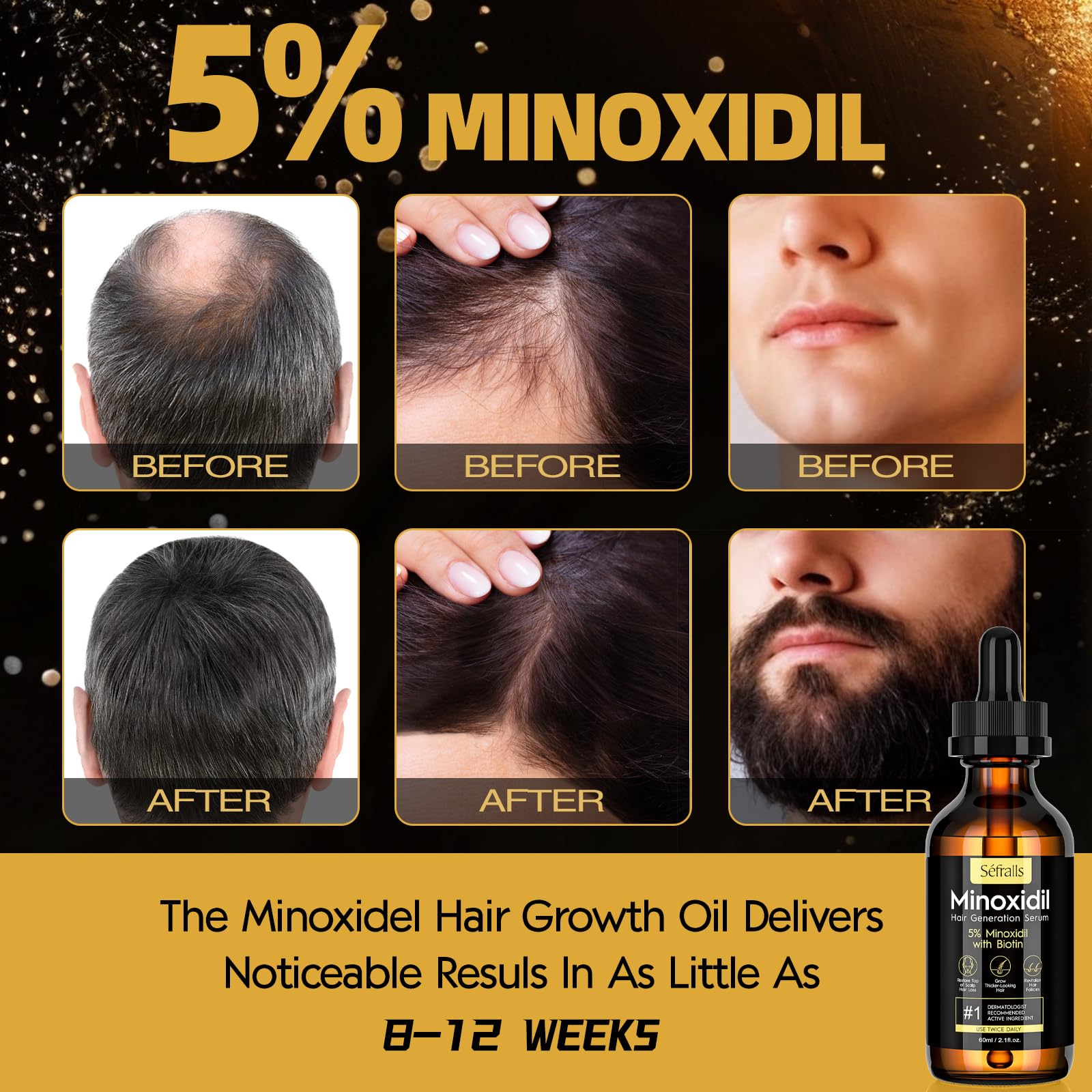 5% Minoxidil Hair Growth Serum Oil For Men and Women, Biotin Hair Serum, Safest Hair Regrowth Treatment, Prevent Scalp Hair Loss 60ml / 2.11 fl.oz