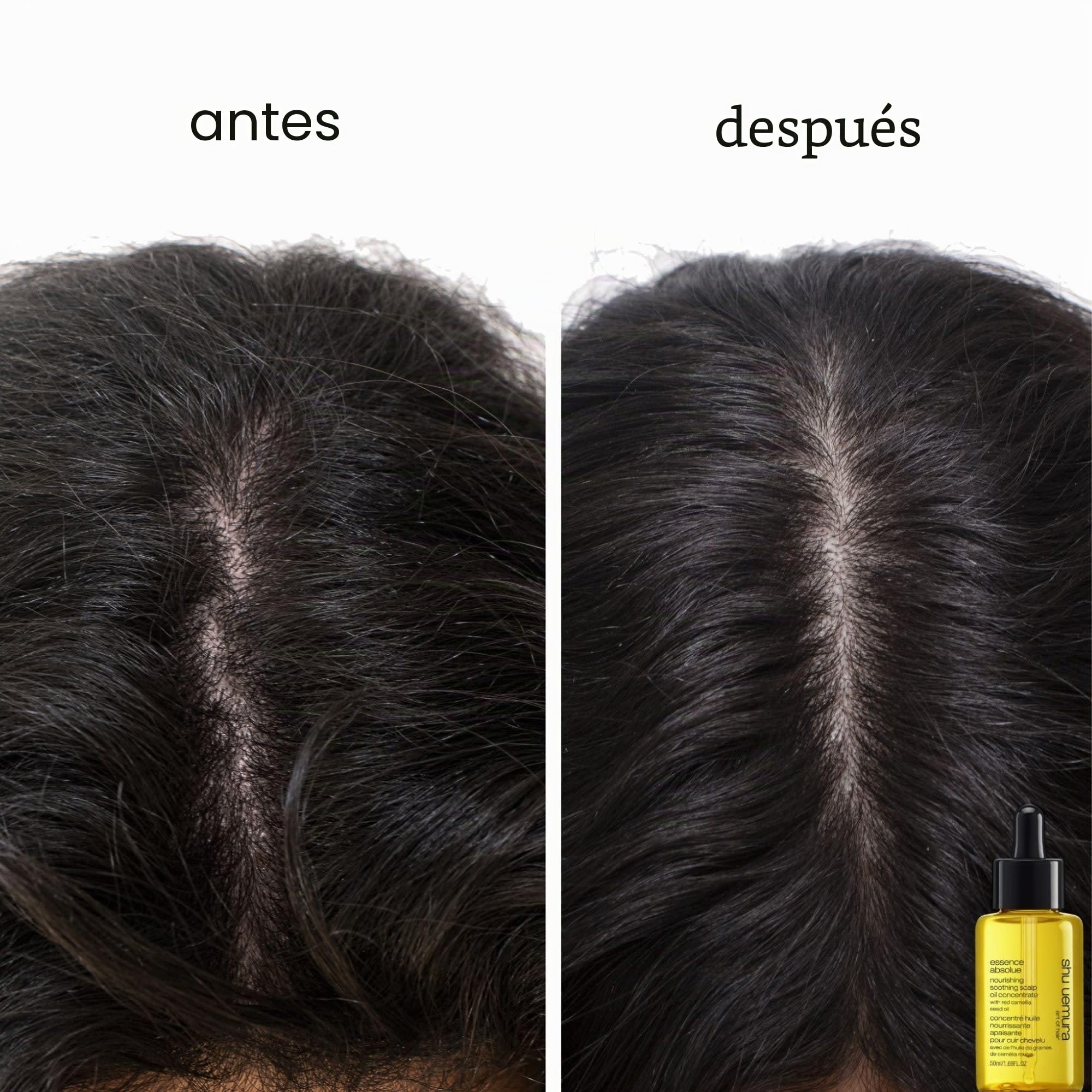 Shu Uemura Aceite Capilar Concentrado Essence Absolue, Aceite Nutritivo Calmante para el Cuero Cabelludo, Alivia el Picor y la Sequedad, 50 ml