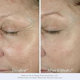 Obagi ELASTIderm Eye Cream - Lightweight, Smooth Formula Clinically Proven to Help Reduce the Appearance of Fine Lines & Wrinkles - Two Pack, 2 * 0.5 oz