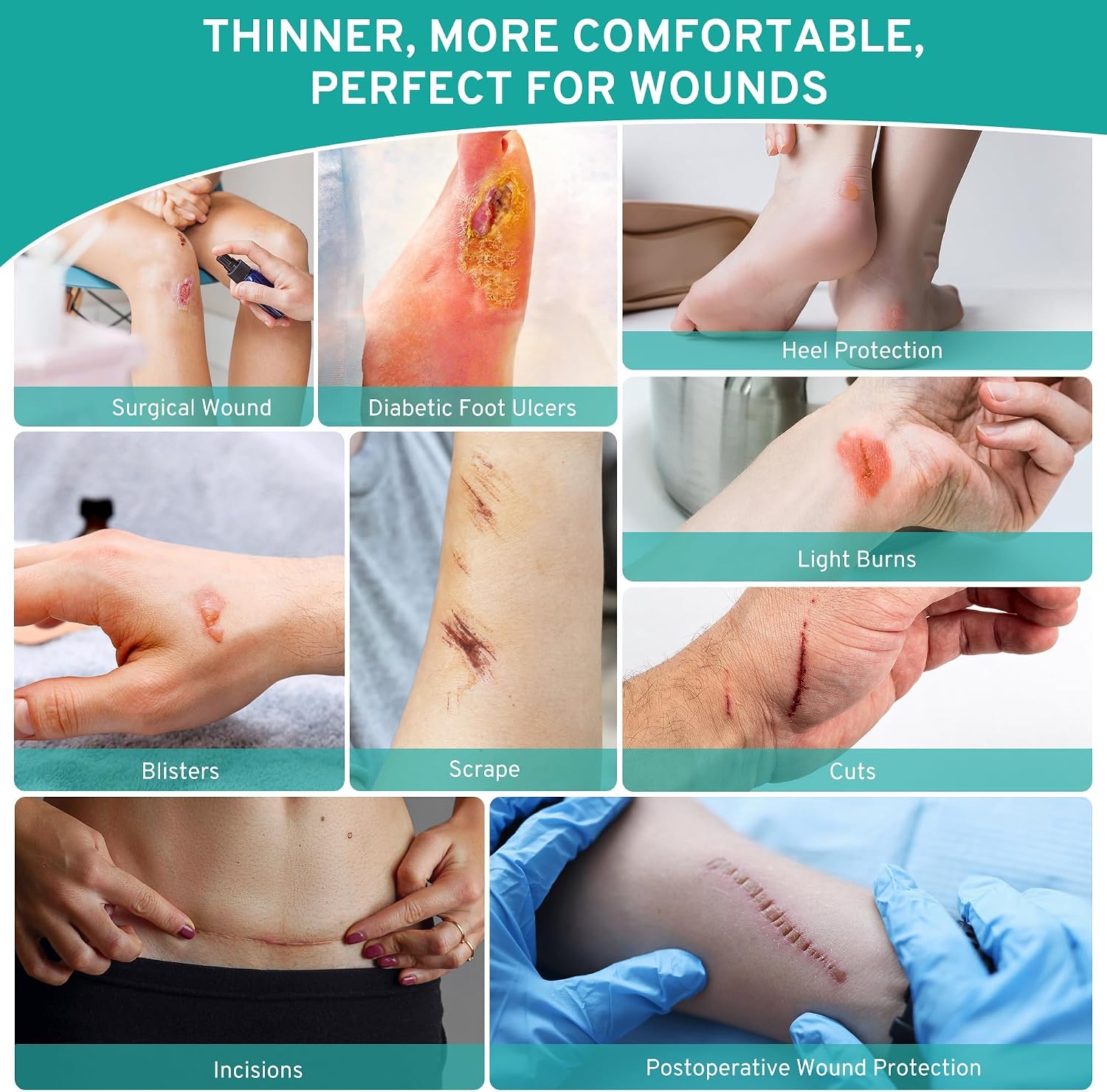 Upadated Hydrocolloid Bandages,2in*12ft Hydrocolloid Roll for Wound Care,Medical-Grade Hydrocolloid Patch Bandages with Self-Adhesive, Flexible & Waterproof DIY Size & Shape First Aid Essential