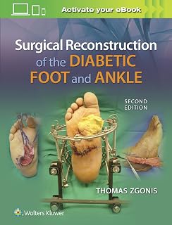Surgical Reconstruction of the Diabetic Foot and Ankle