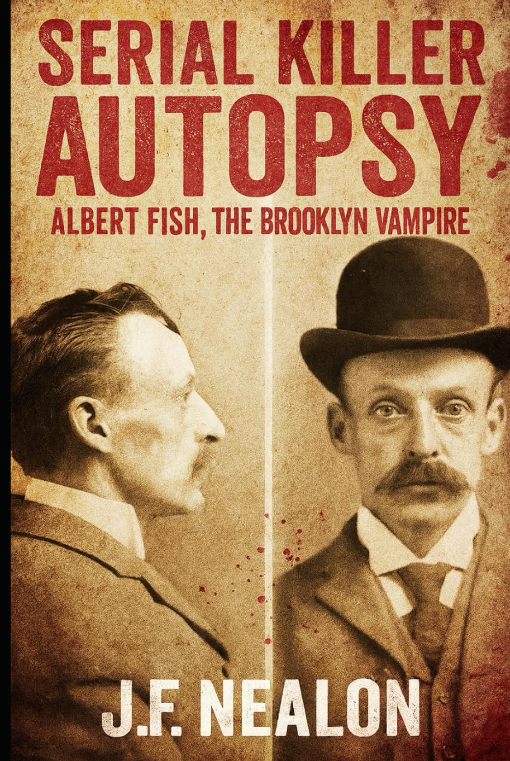 Serial Killer Autopsy: Albert Fish, The Brooklyn Vampire