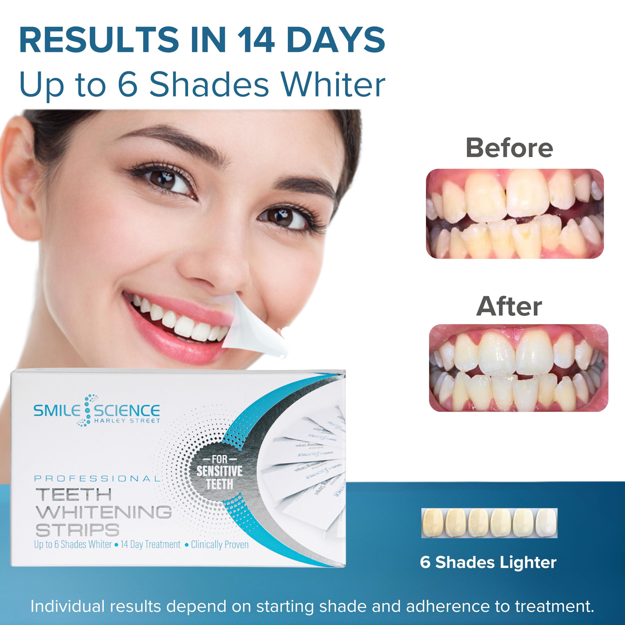 Smile Science Harley Street - Strisce sbiancanti professionali per denti - 28 strisce - Fino a 6 tonalità più bianche in 14 giorni - Sicuro per lo smalto al 100% - Vegano - Smacchiatore per denti