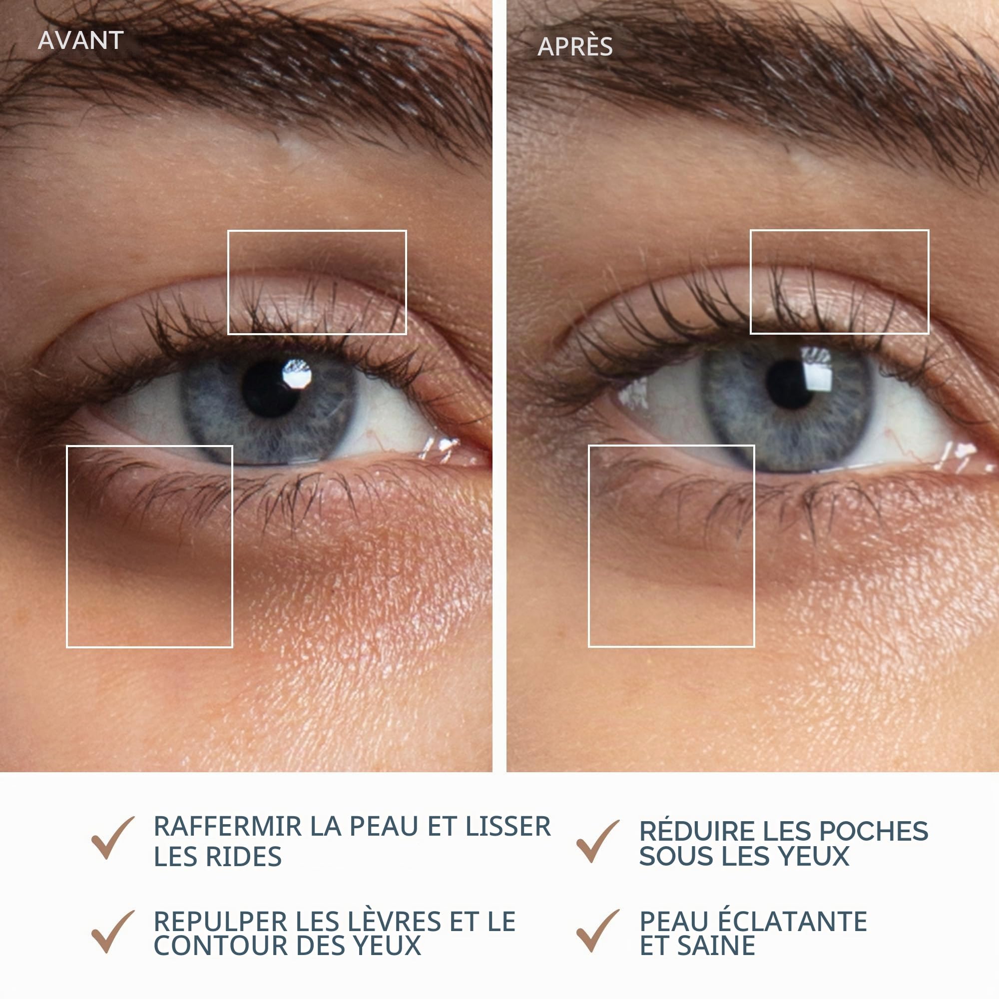 FOREO SUPERCHARGED Eye & Lip Contour Booster ; Gel conducteur ; Sérum à la niacinamide ; Anti;âge ; Repulpant lèvres et contour des yeux antipoches ; Format voyage ; 3 capsules x 3,5 ml