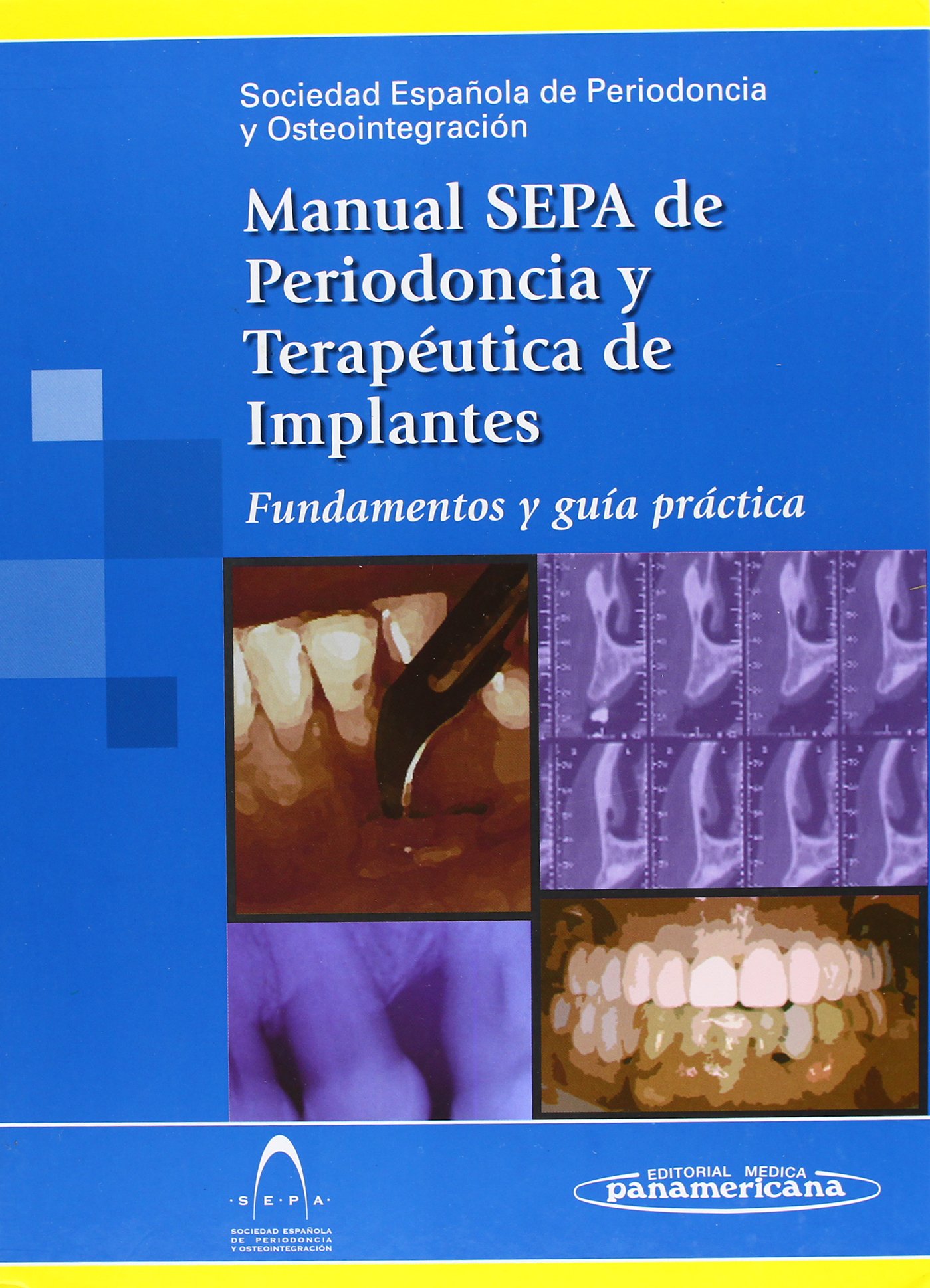 Manual sepa de periodoncia y terapeutica de implan