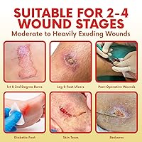 Vista 6 de HEALQU Apósito de espuma de silicona con borde de 2 x 2 pulgadas, caja de 10 – para un cuidado óptimo de heridas, núcleo superabsorbente multicapa