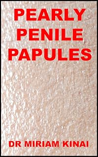 Pearly Penile Papules